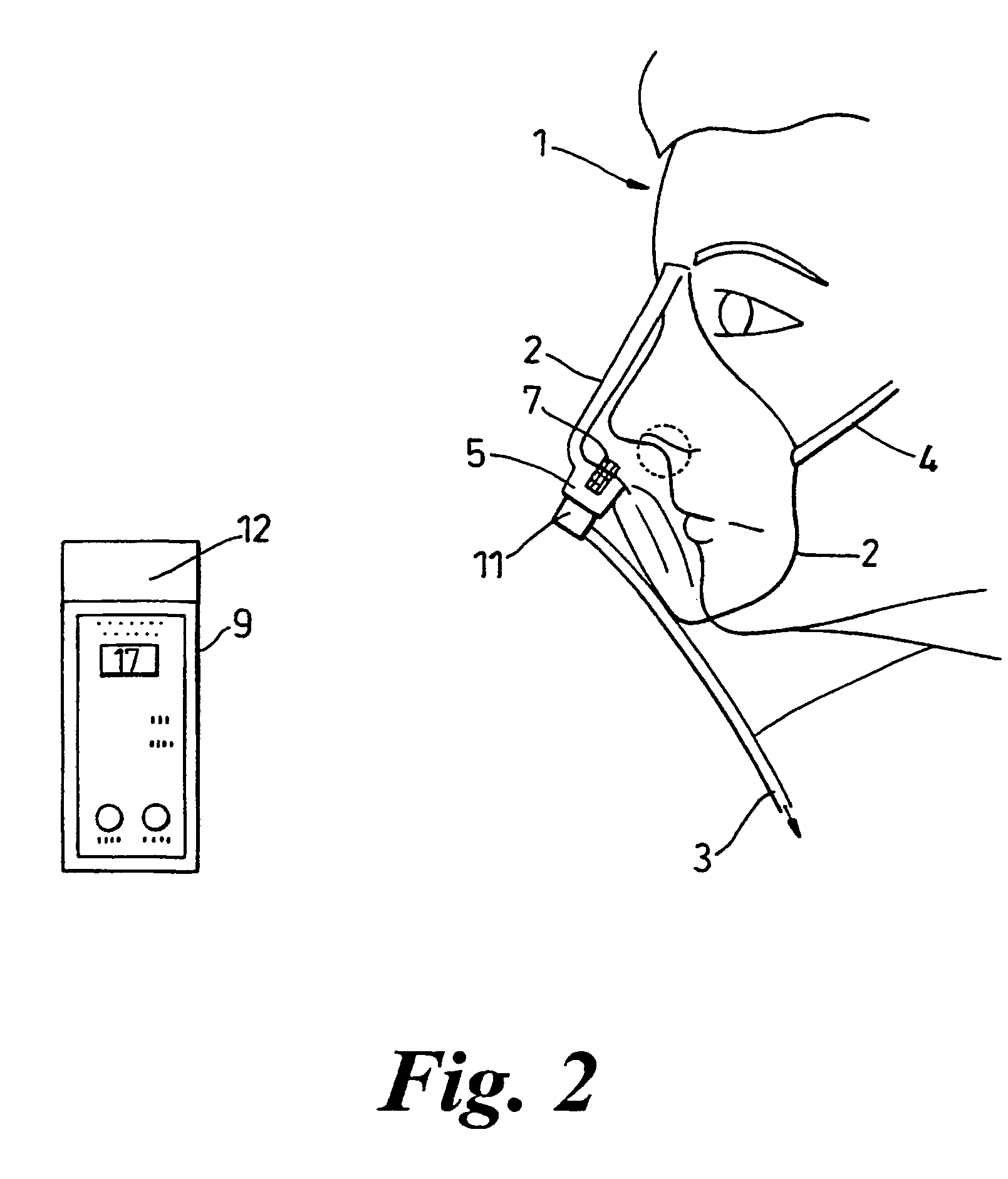 Respiration monitoring equipment