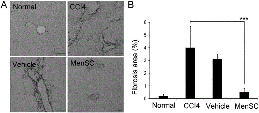 Application of endometrium stem cell in preparation of medicine for curing liver fibrosis