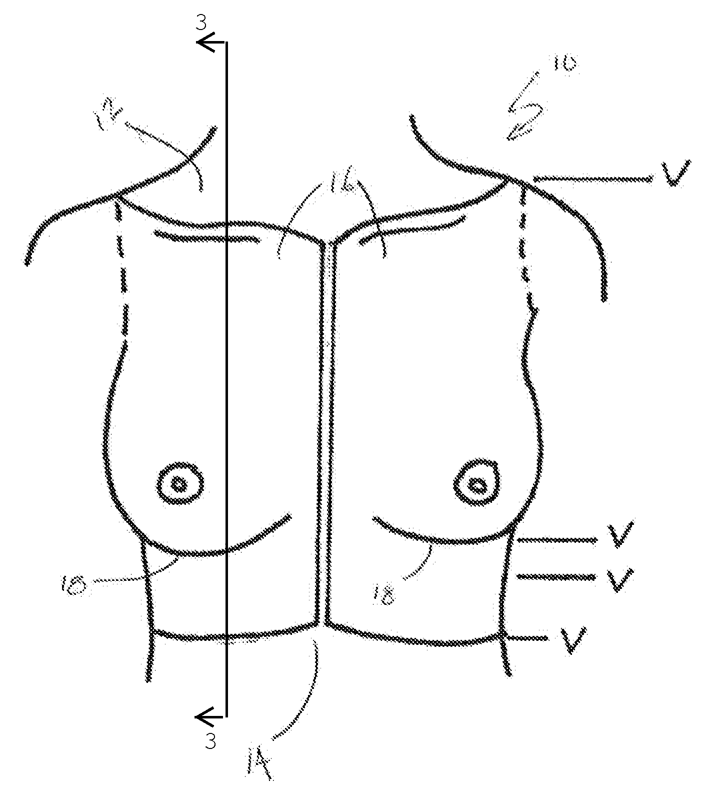 Breast implant teaching model