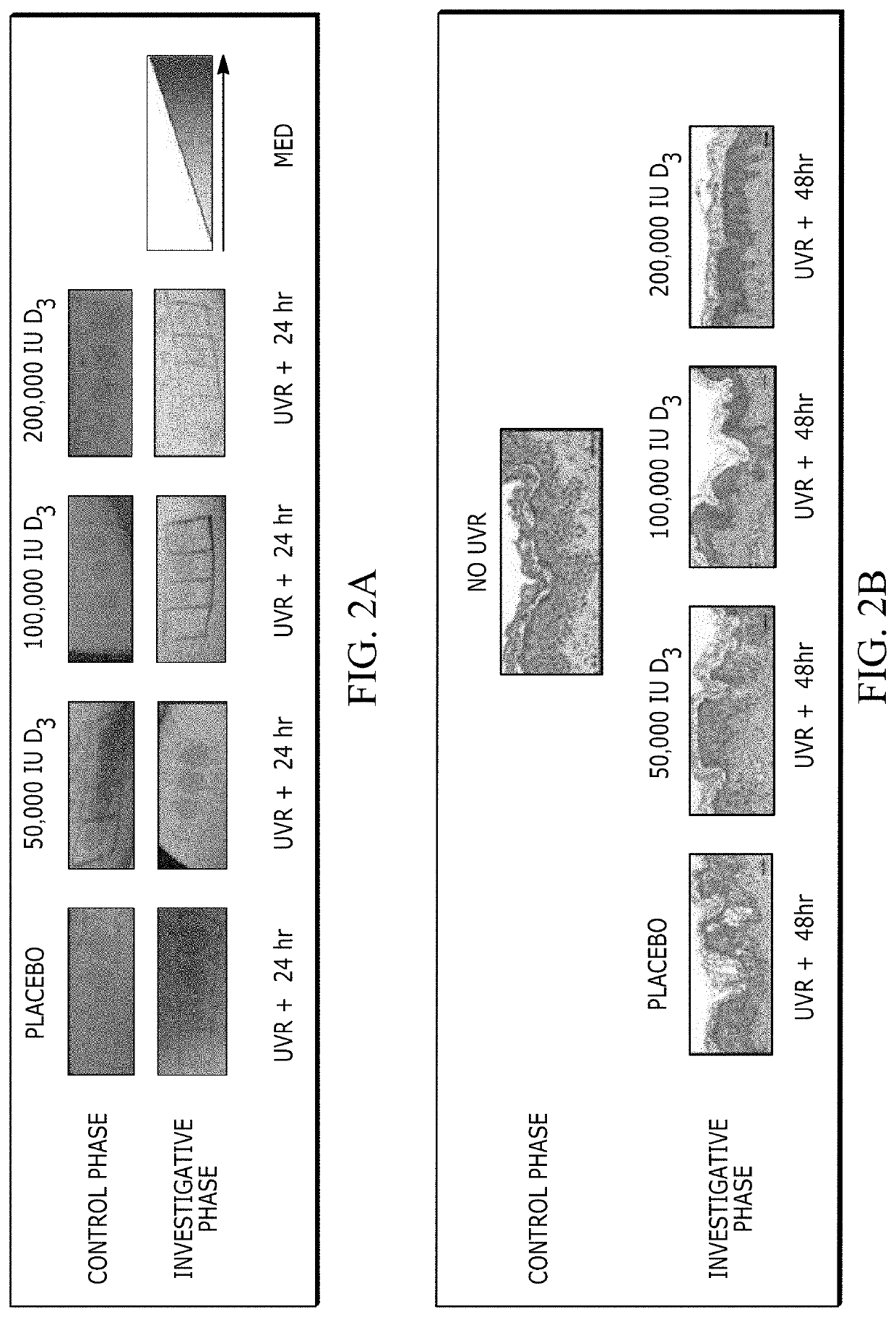 Autophagy activators for treating or preventing skin injury