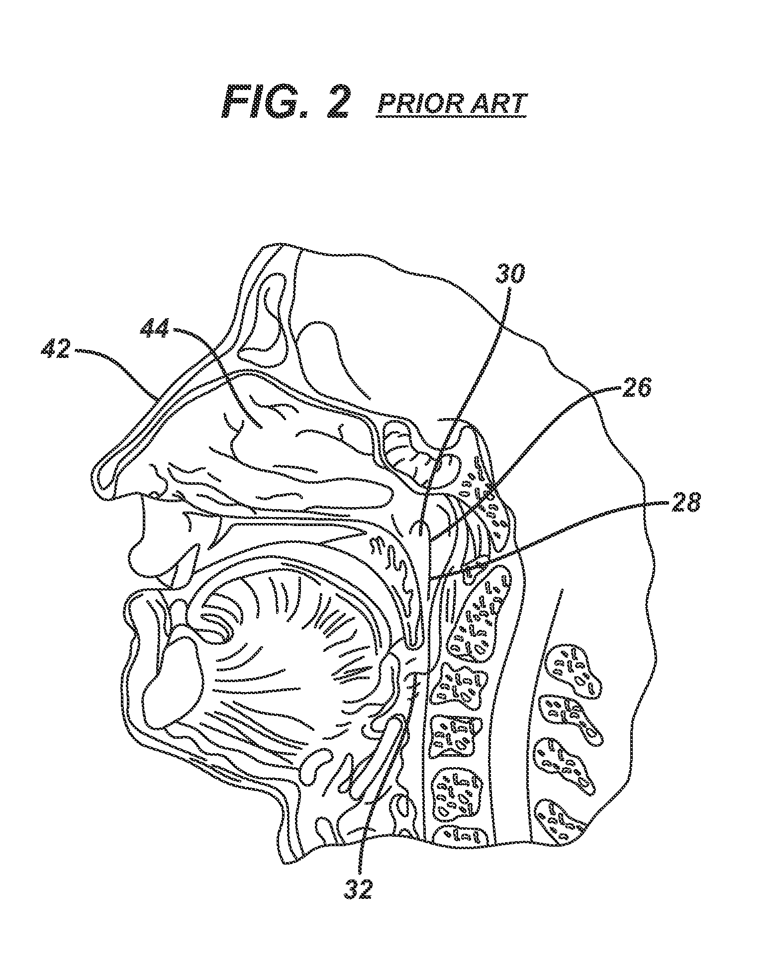 Method and System for Eustachian Tube Dilation