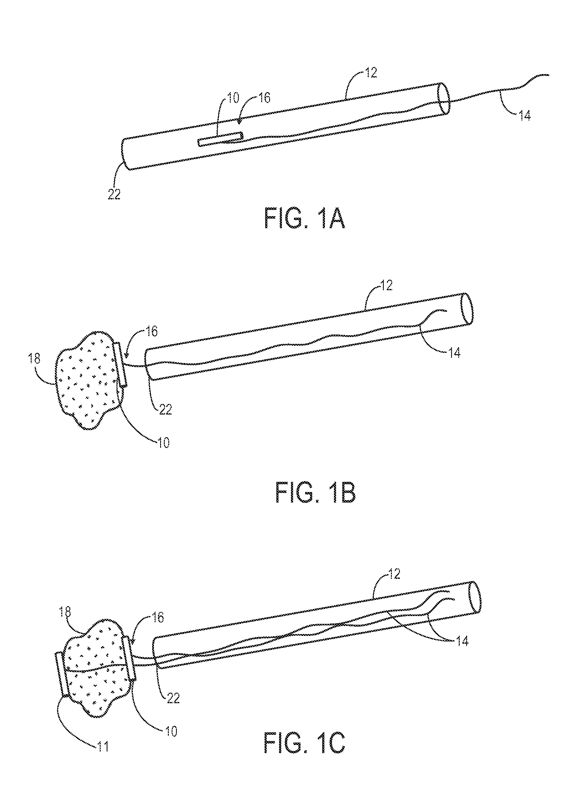 System and method for a tissue resection margin measurement device