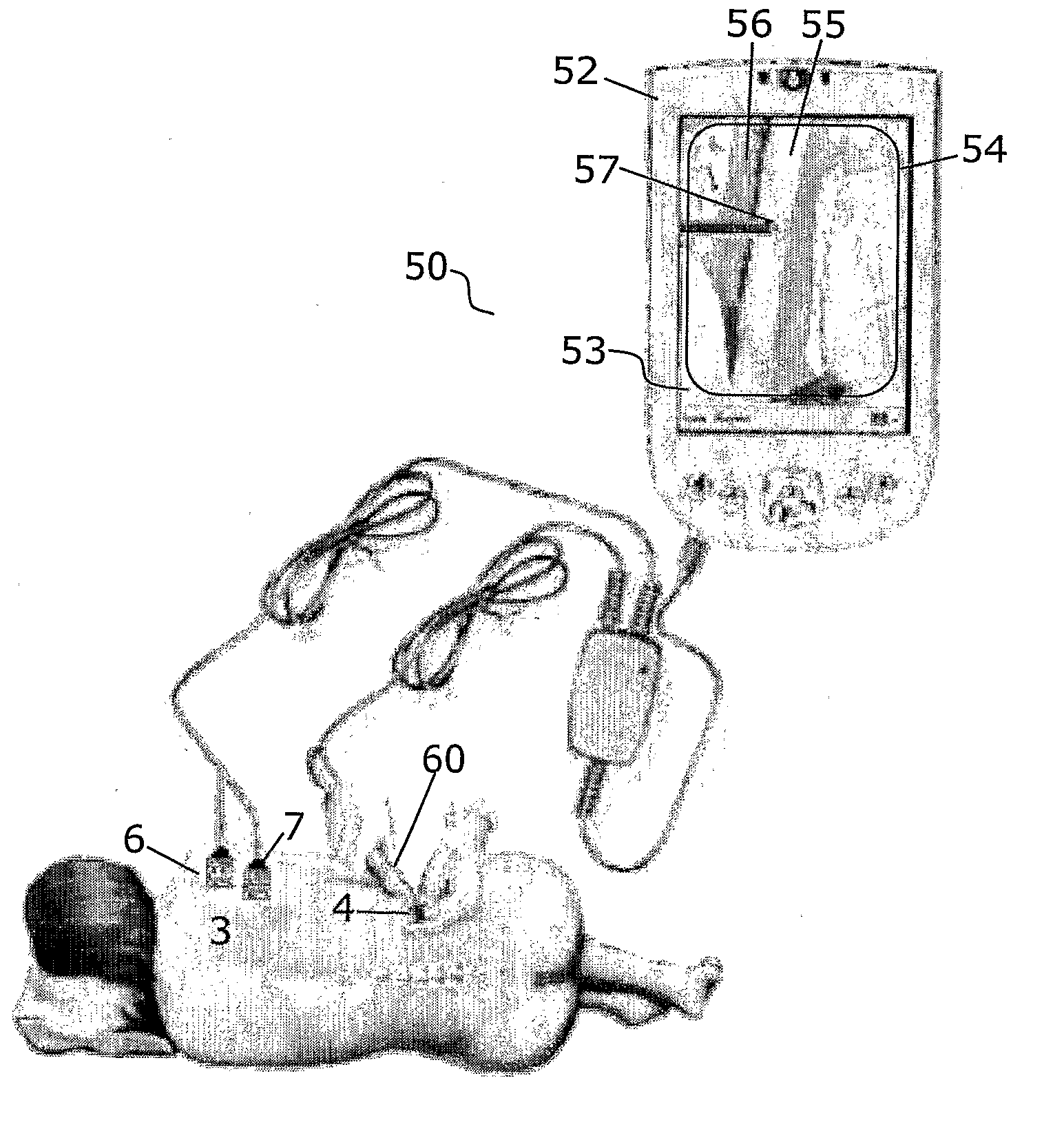 Method and apparatus for determining local tissue impedance for positioning of a needle