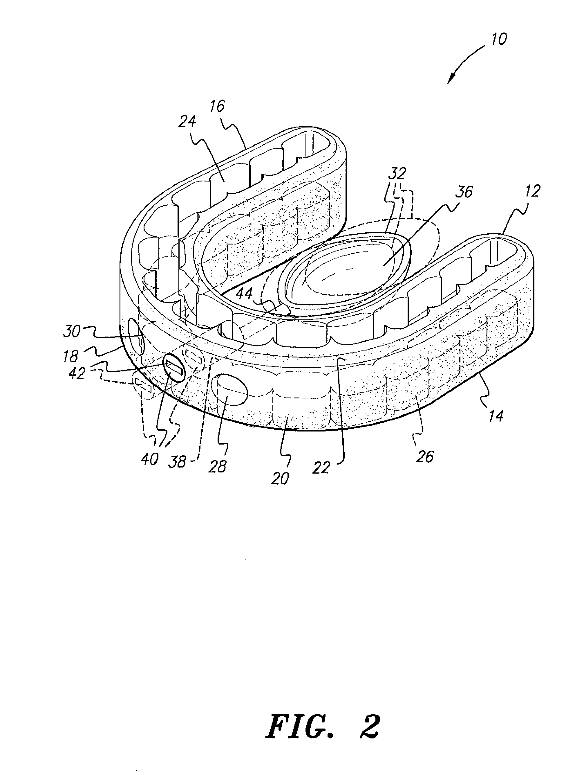 Oral appliance for the treatment of sleep apnea