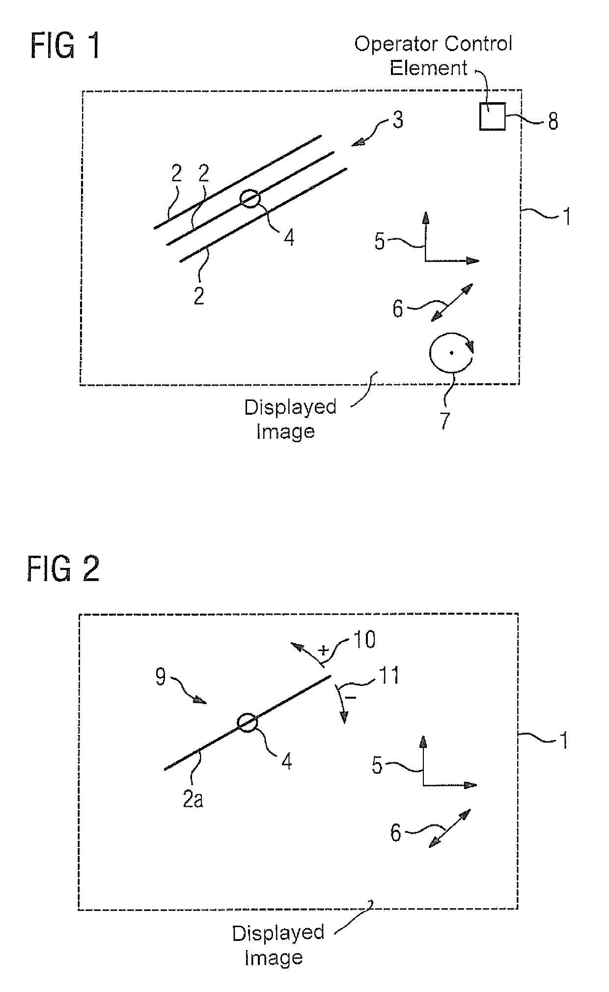 Method and magnetic resonance apparatus for setting acquisition parameters of a scan protocol