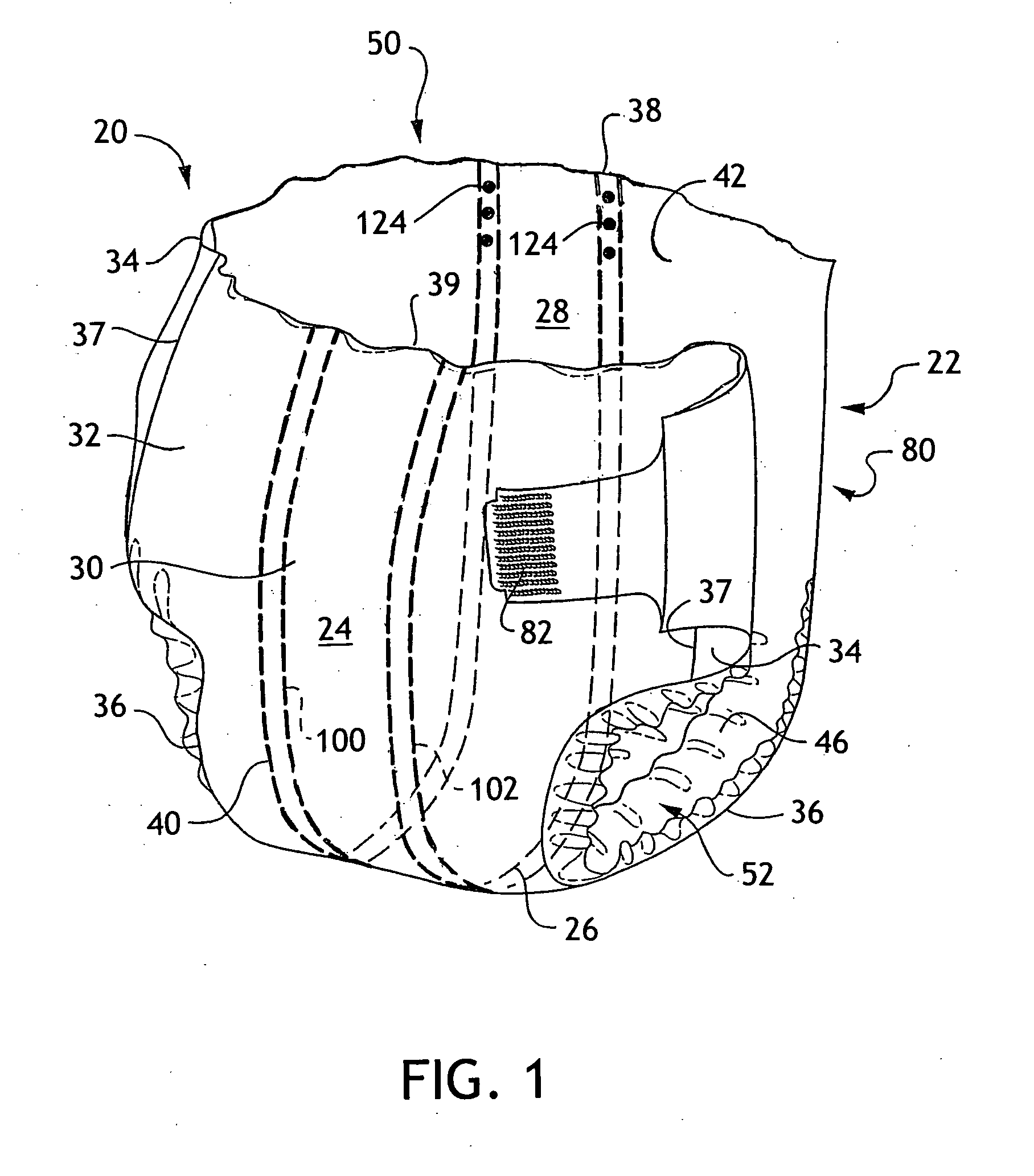 Absorbent articles with external access to internal conductors