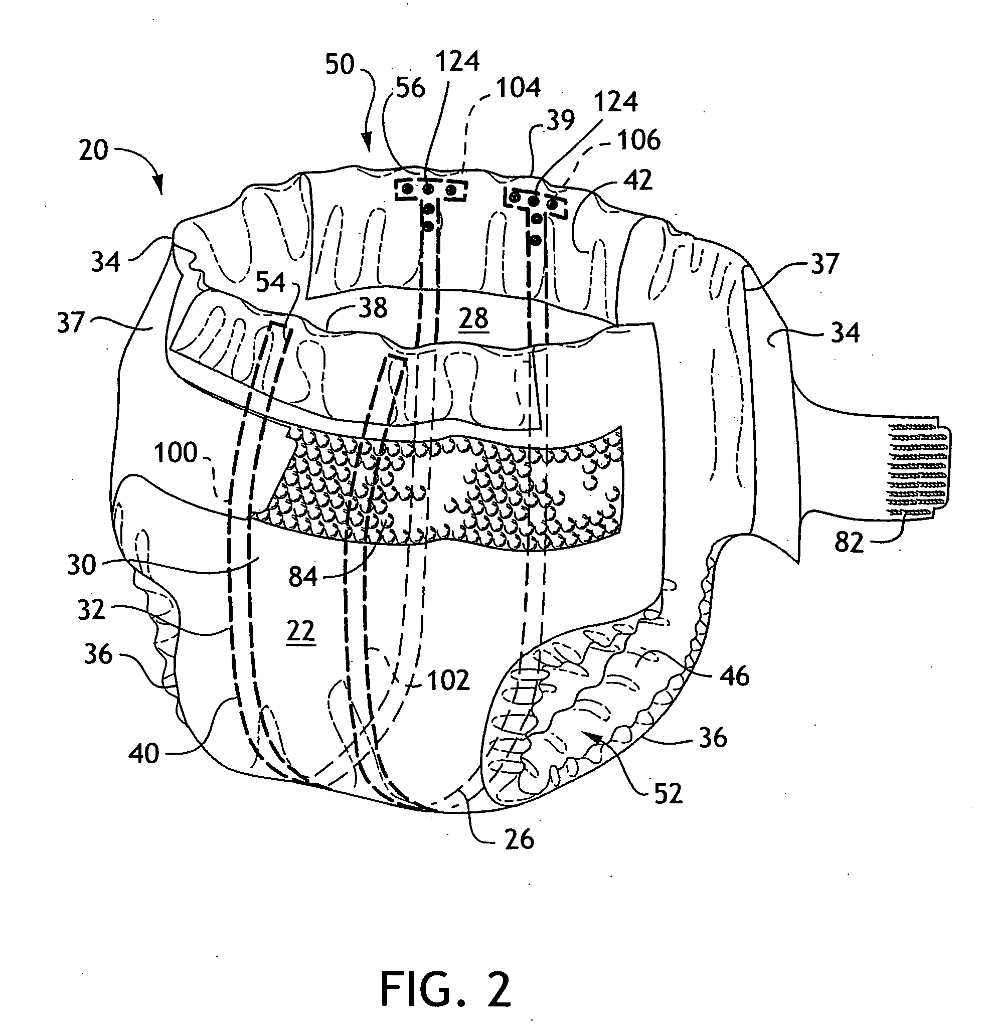 Absorbent articles with external access to internal conductors