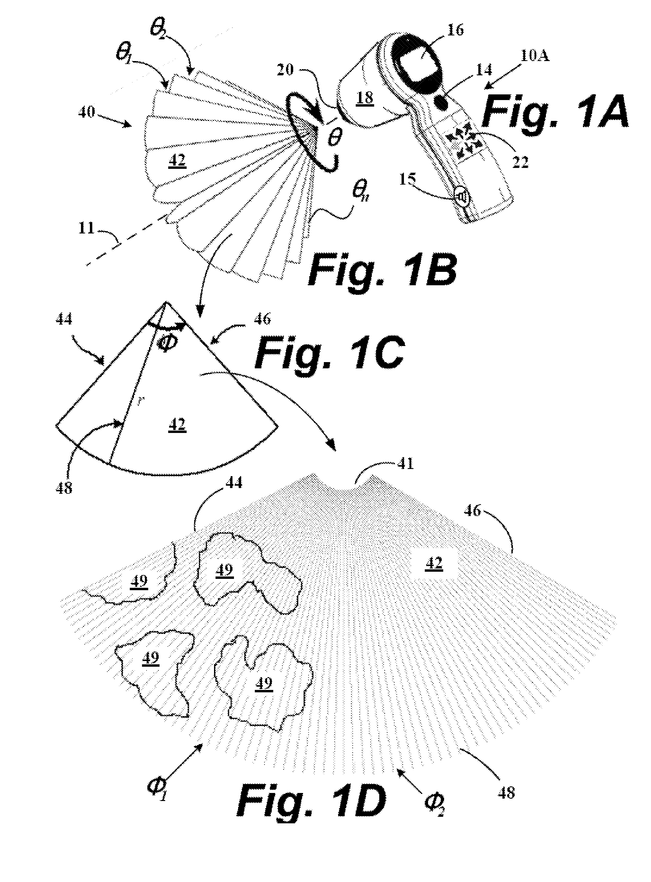 Systems and methods to improve clarity in ultrasound images