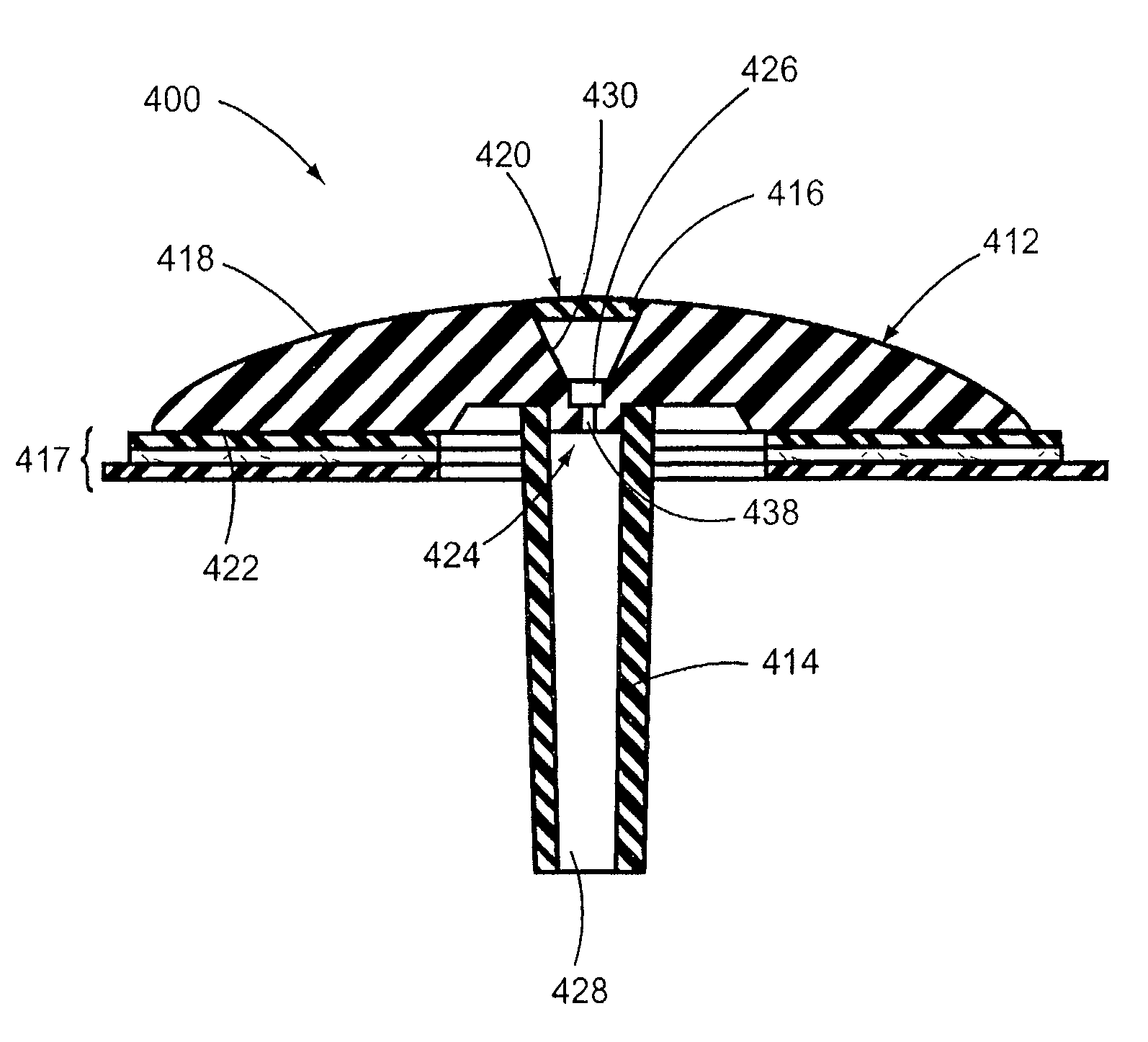 Infusion device