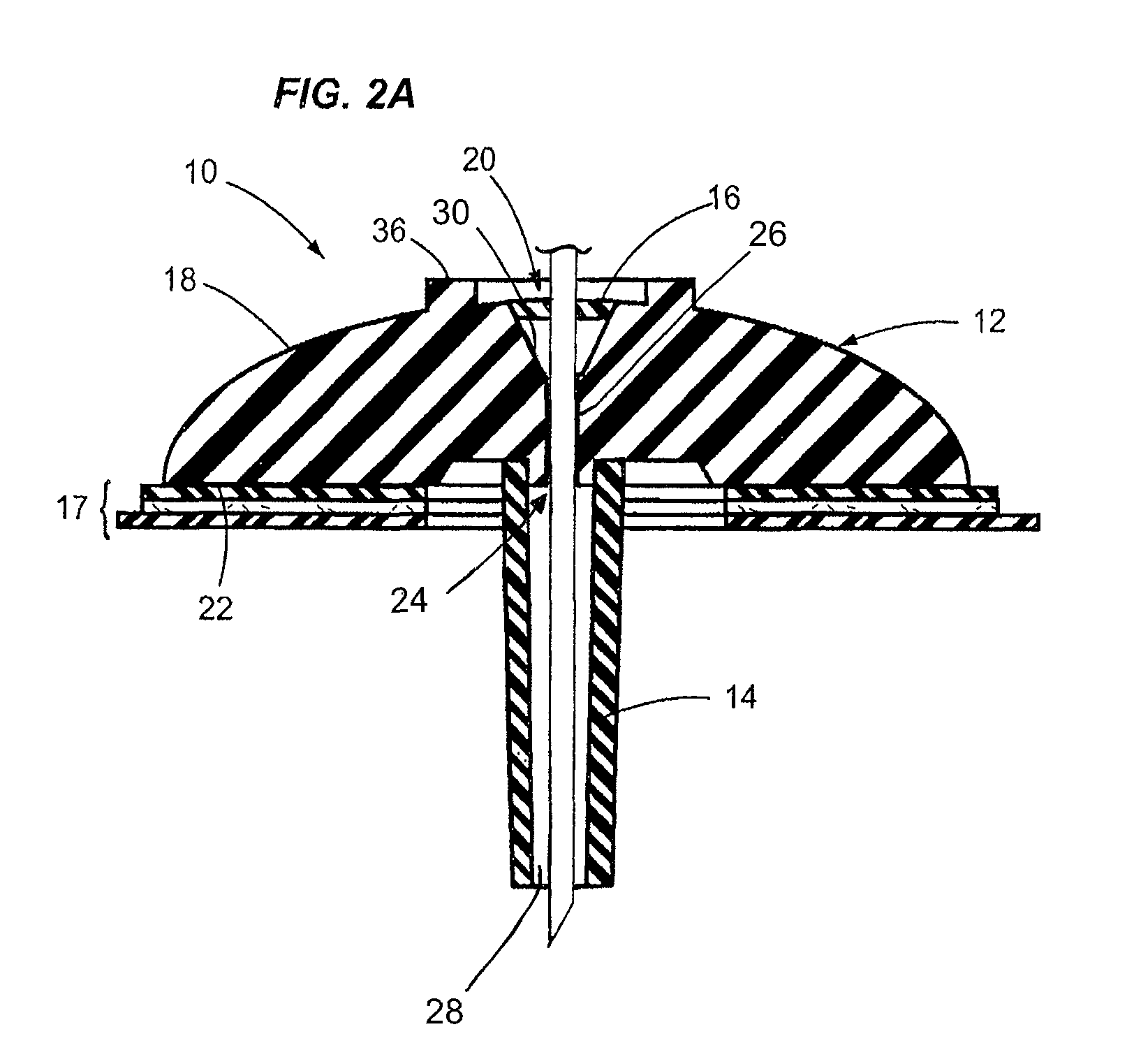 Infusion device