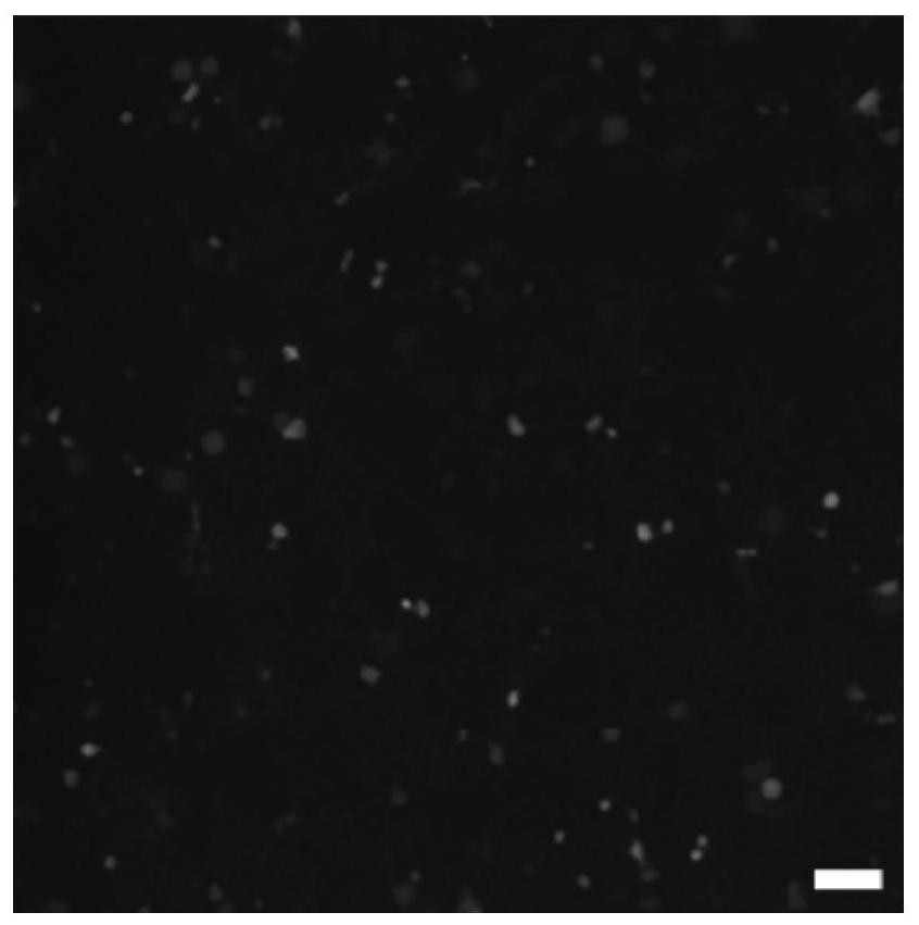 Preparation method and application of engineering bionic exosome for delivering specific protein