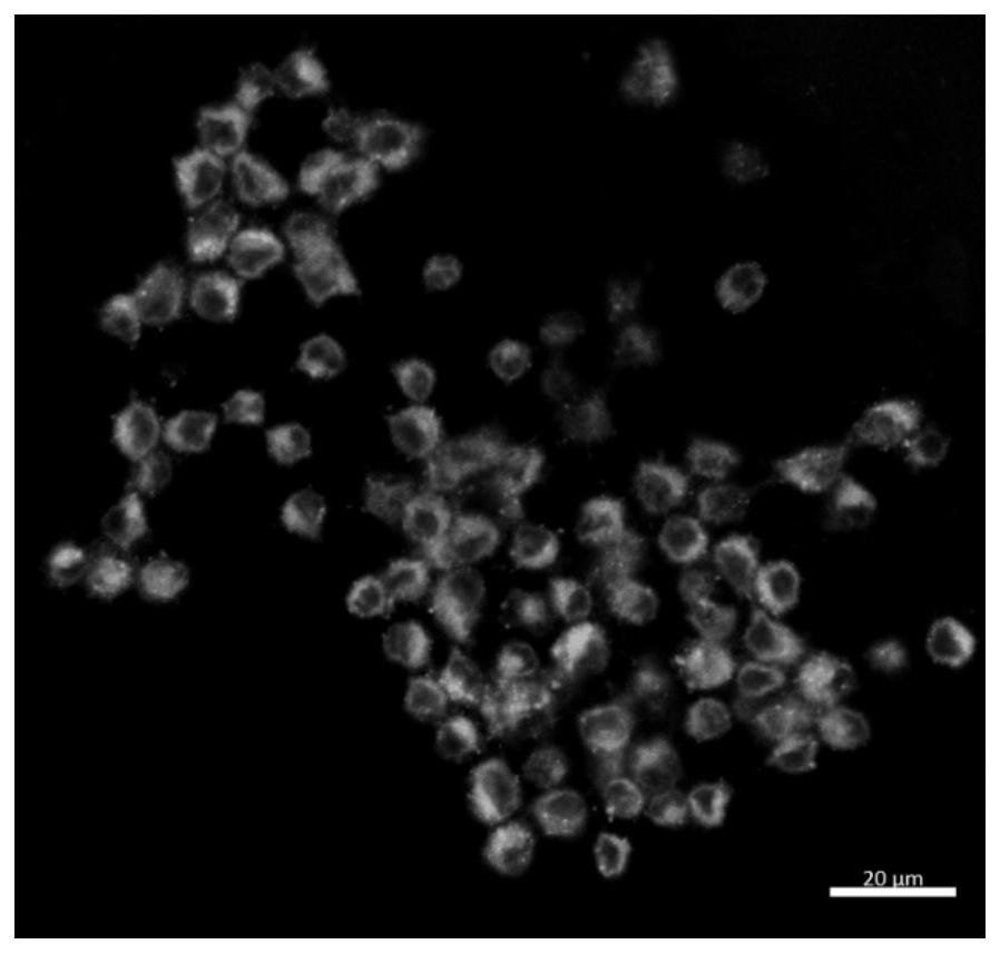 Preparation method and application of engineering bionic exosome for delivering specific protein