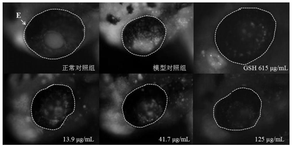 Application of potentilla fruticosa extract in inhibition of eye cell apoptosis