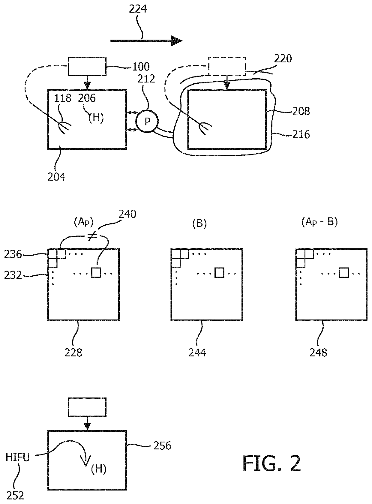 Calibration of ultrasonic elasticity-based lesion-border mapping