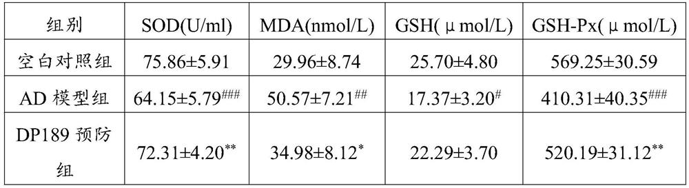 Application of lactobacillus plantarum DP189 in preparation of medicine for preventing and/or treating Alzheimer's disease