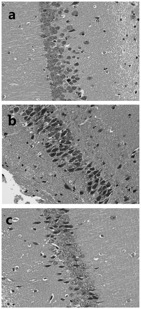 Application of lactobacillus plantarum DP189 in preparation of medicine for preventing and/or treating Alzheimer's disease