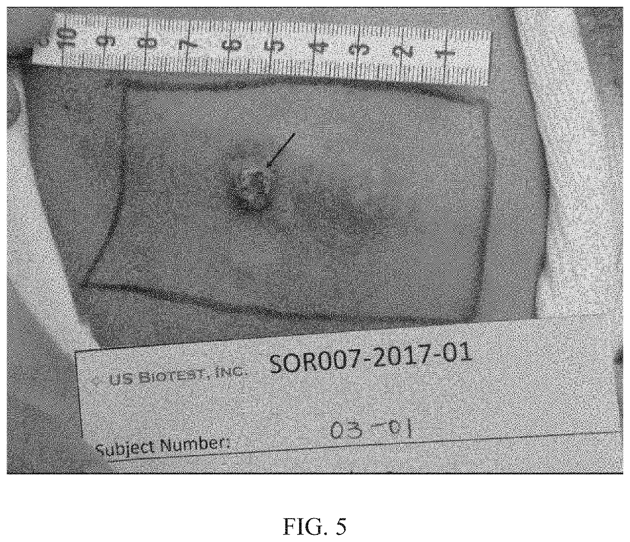 Use of Antineoplastic Agents to Stimulate the Immune System for Treatment of Cancer