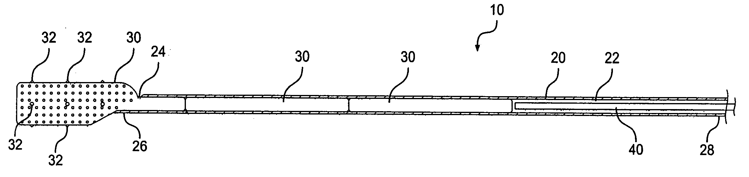 Implant system and method for bulking tissue