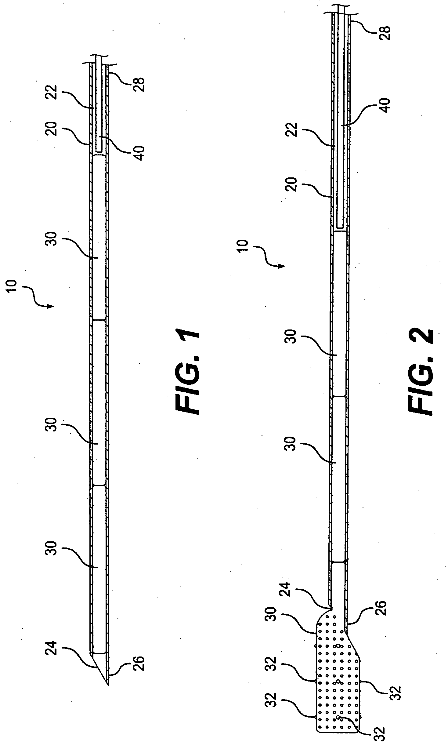 Implant system and method for bulking tissue