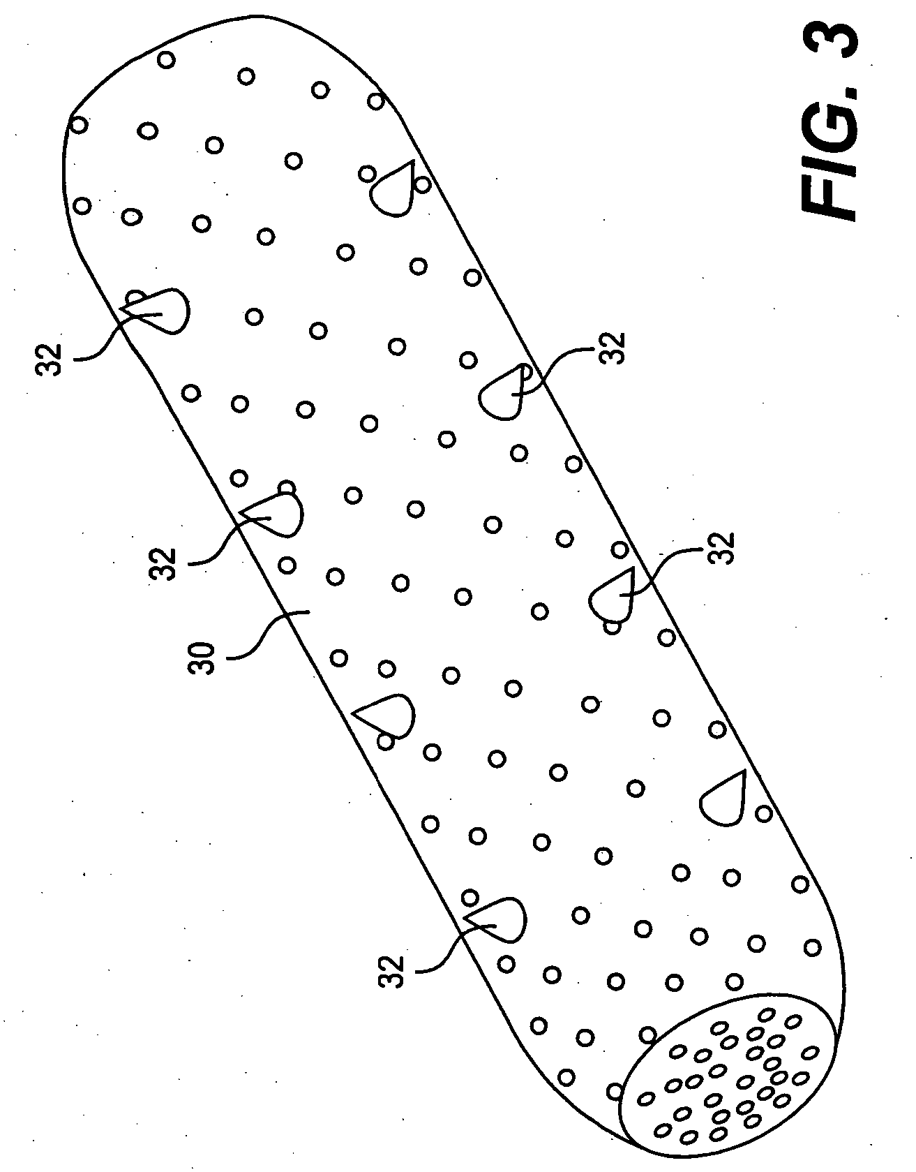 Implant system and method for bulking tissue