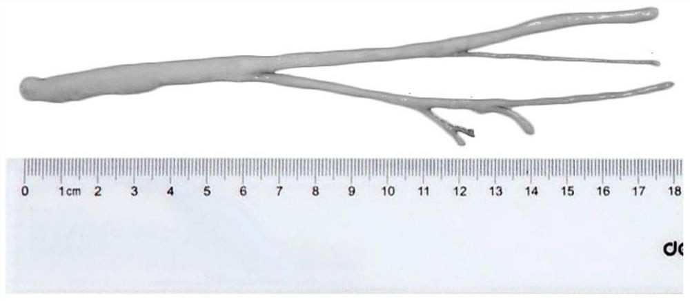 A kind of decellularized nerve graft and preparation method thereof