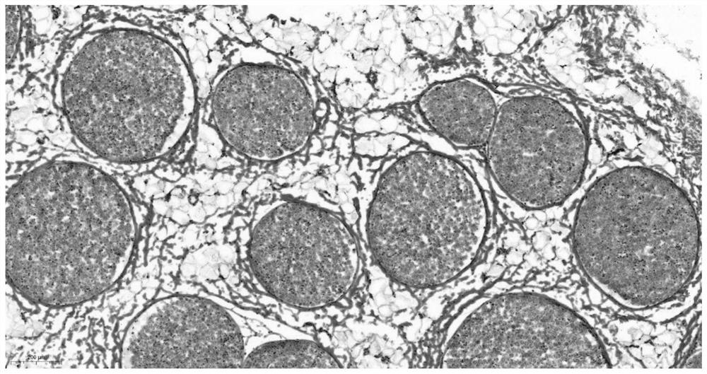 A kind of decellularized nerve graft and preparation method thereof