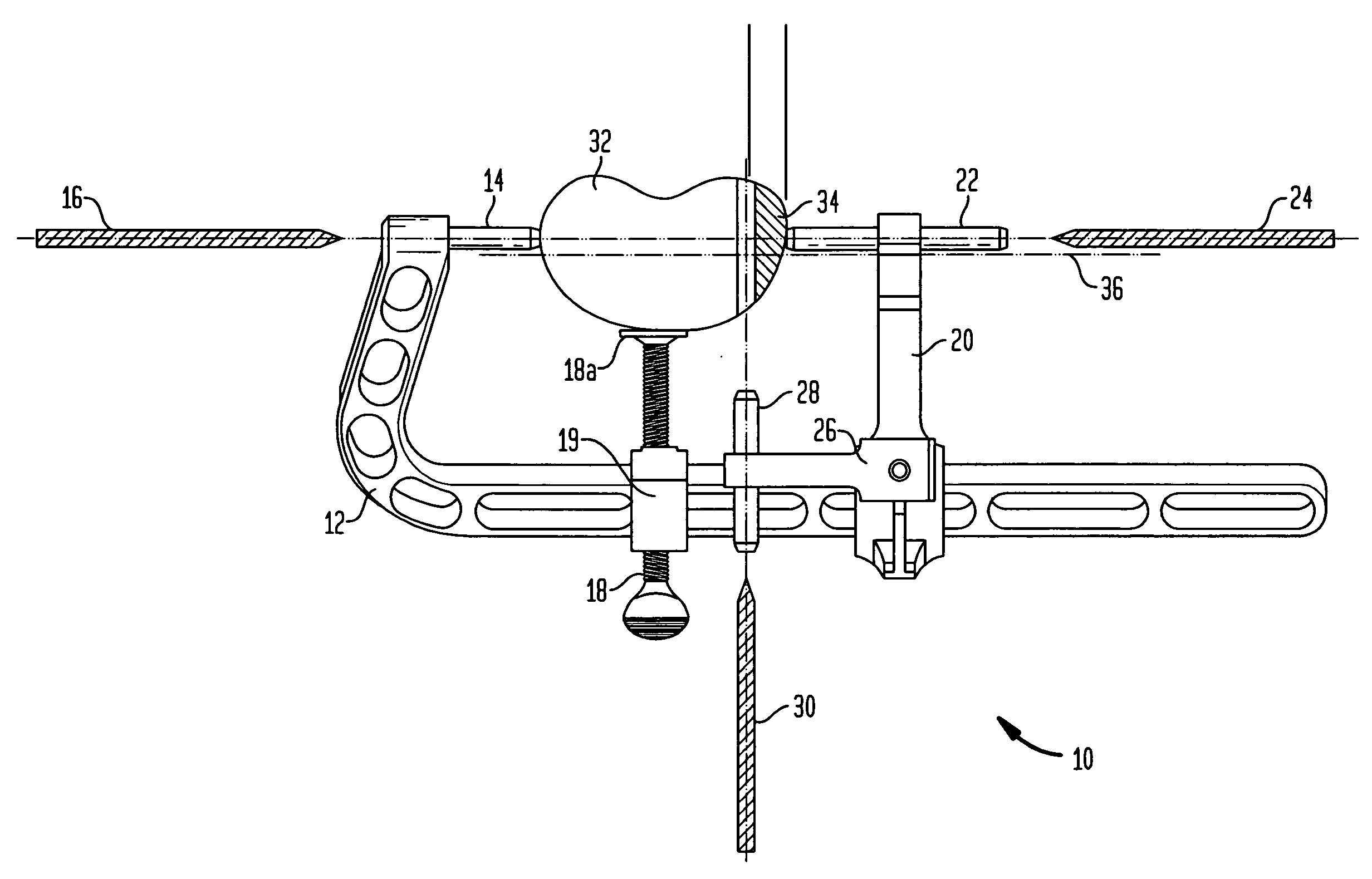 High tibial osteotomy instrumentation