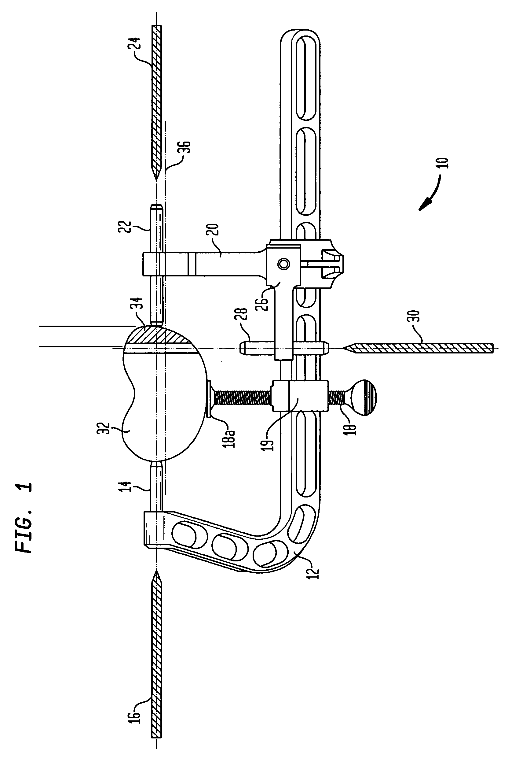 High tibial osteotomy instrumentation