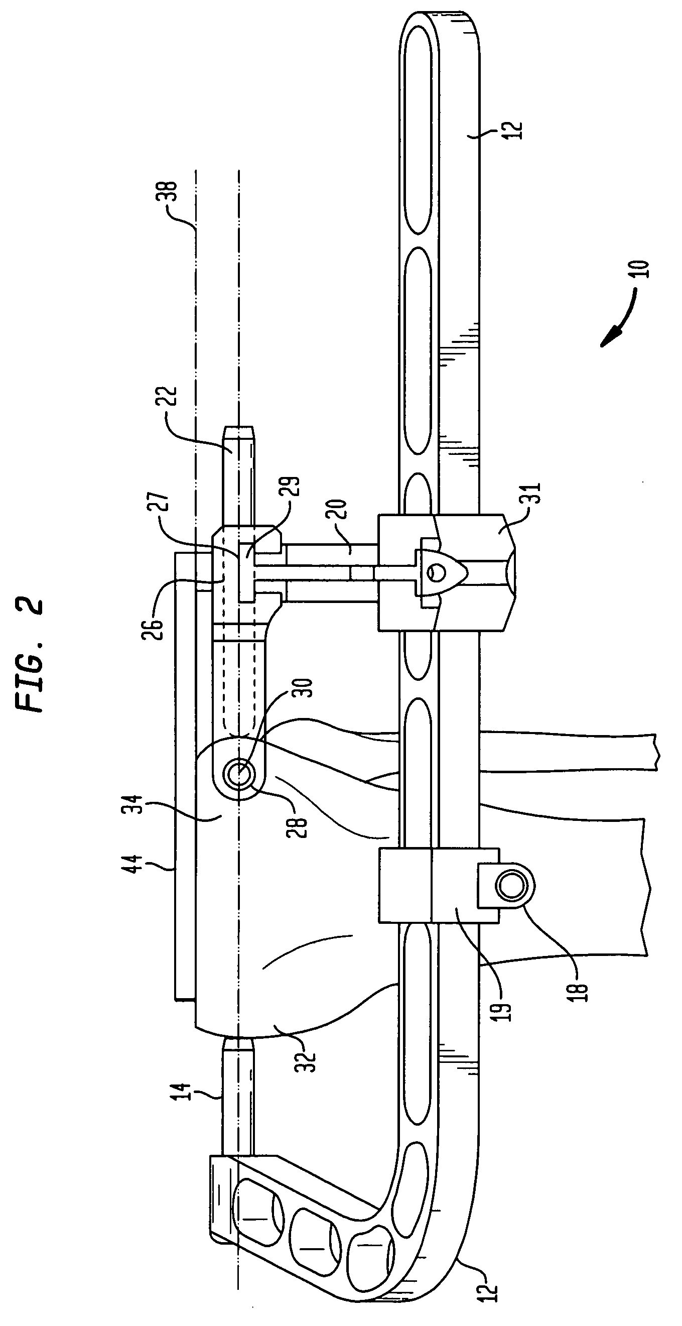 High tibial osteotomy instrumentation