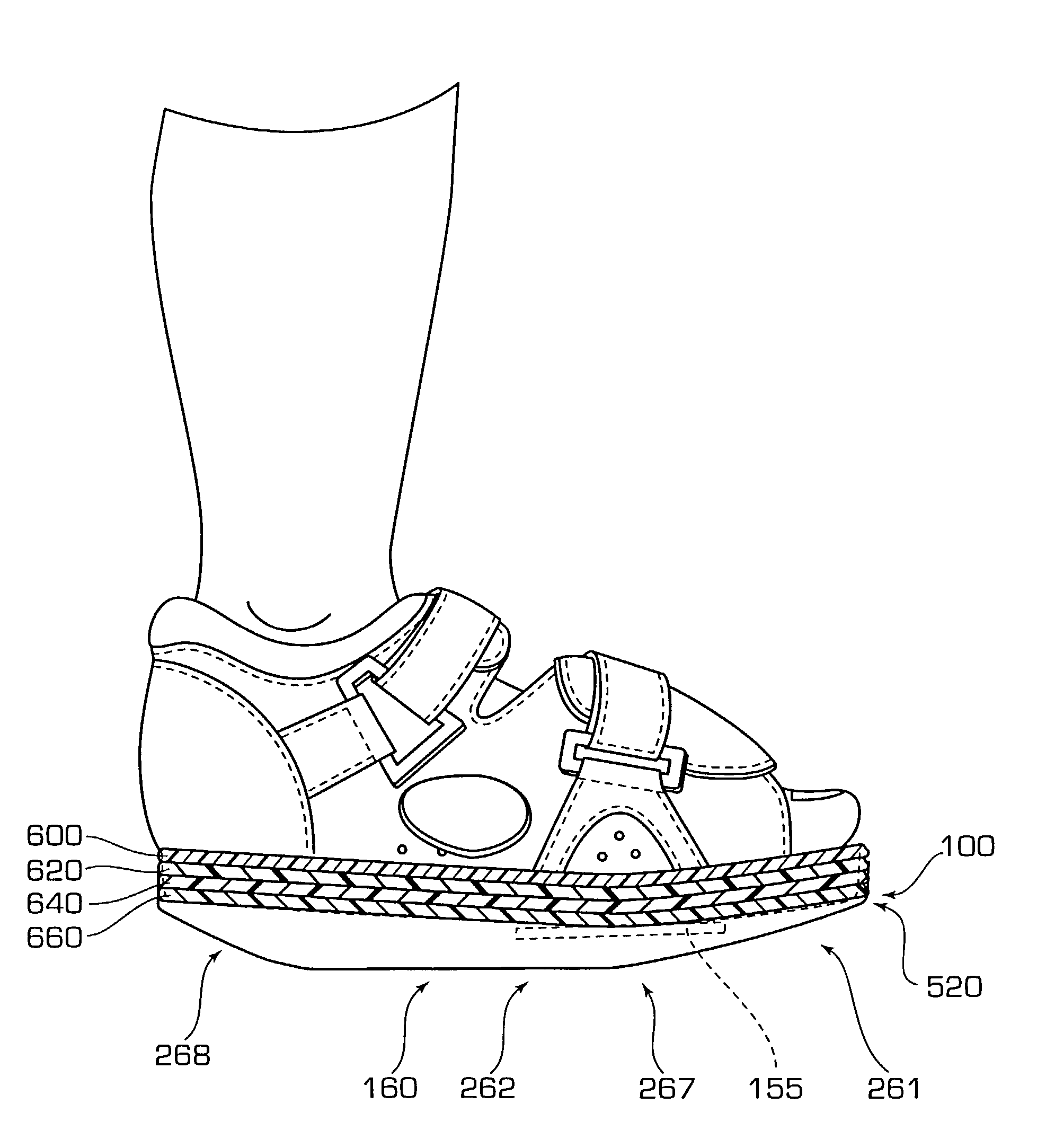 Healing shoe or sandal