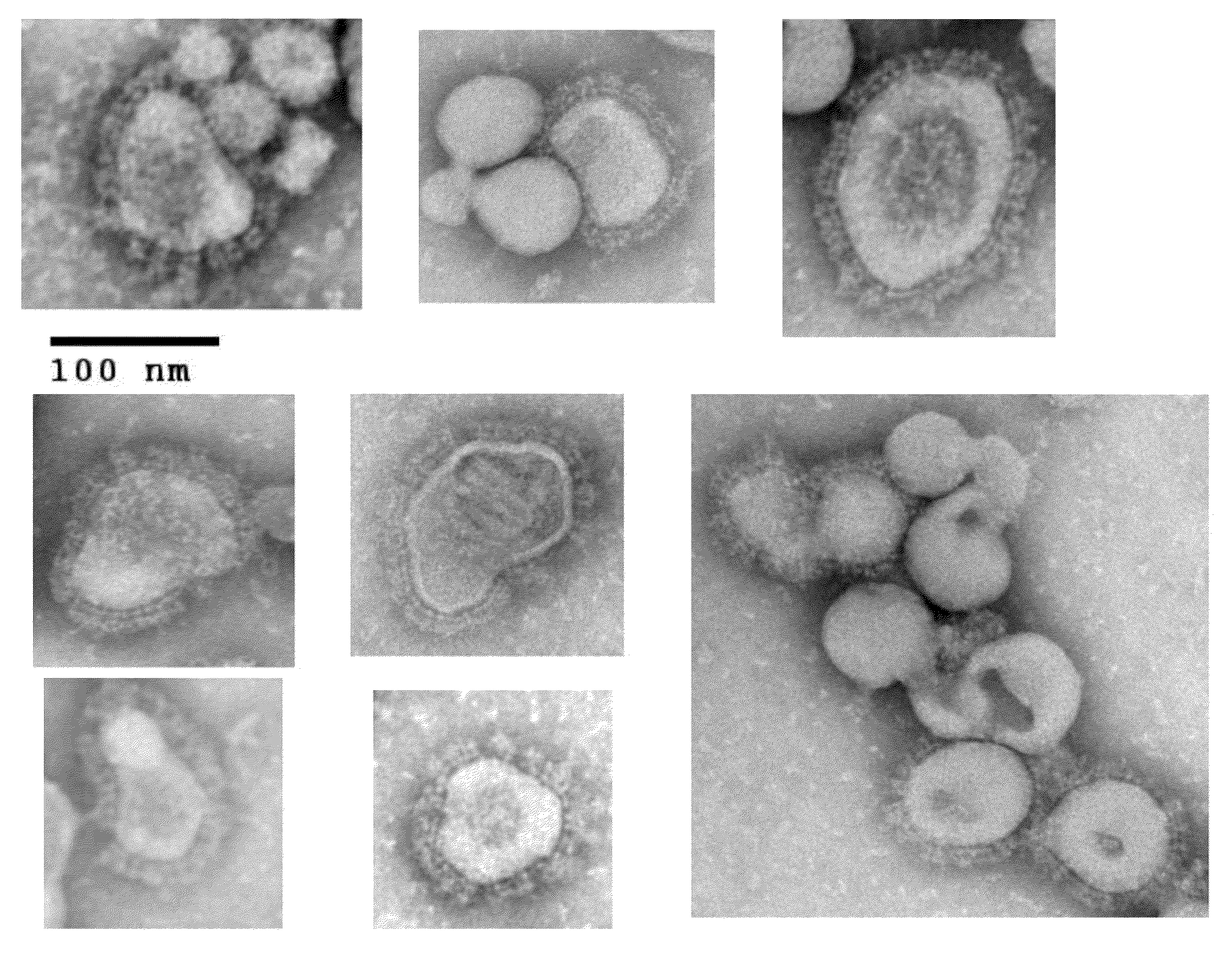 Chimeric varicella zoster virus virus-like particles