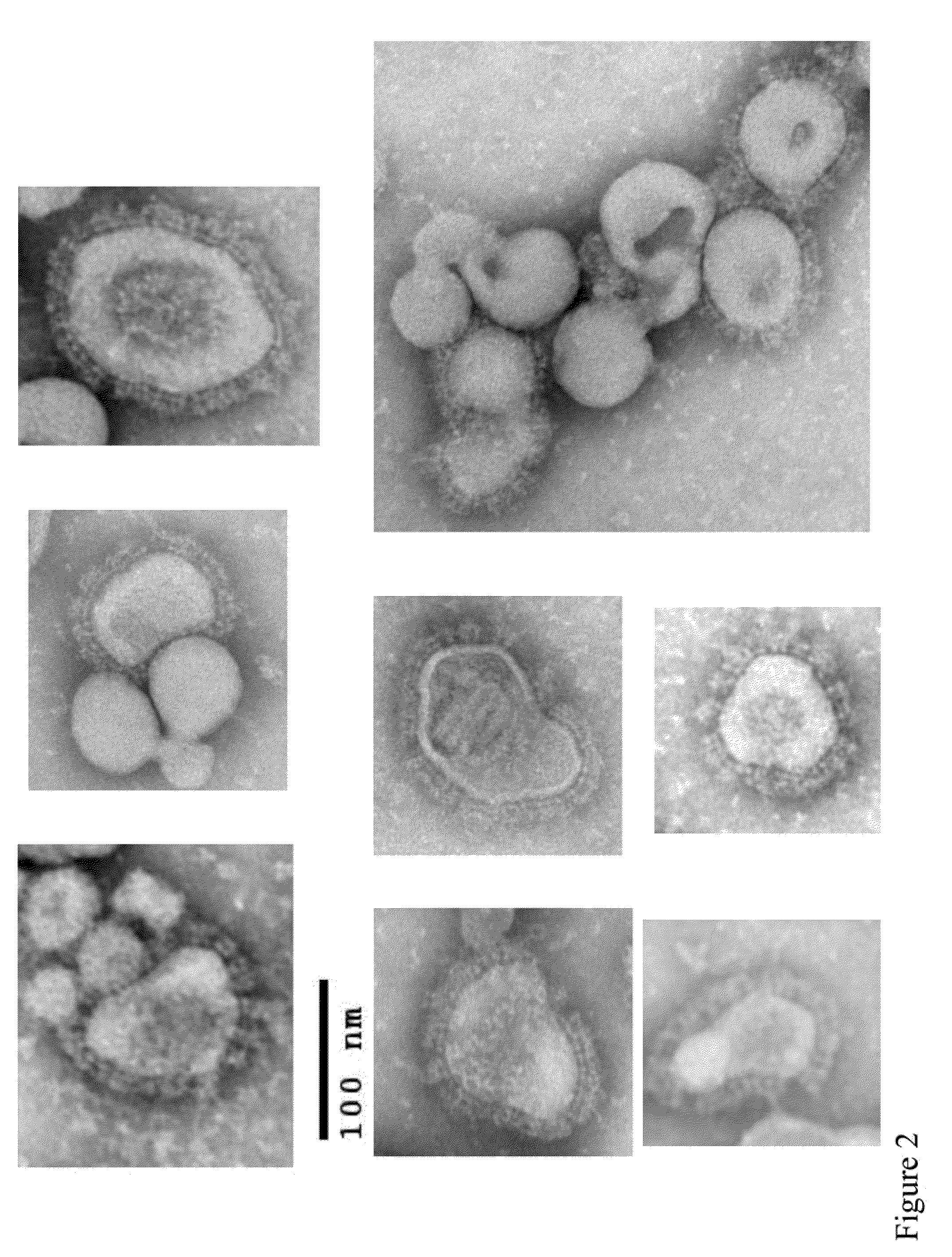 Chimeric varicella zoster virus virus-like particles