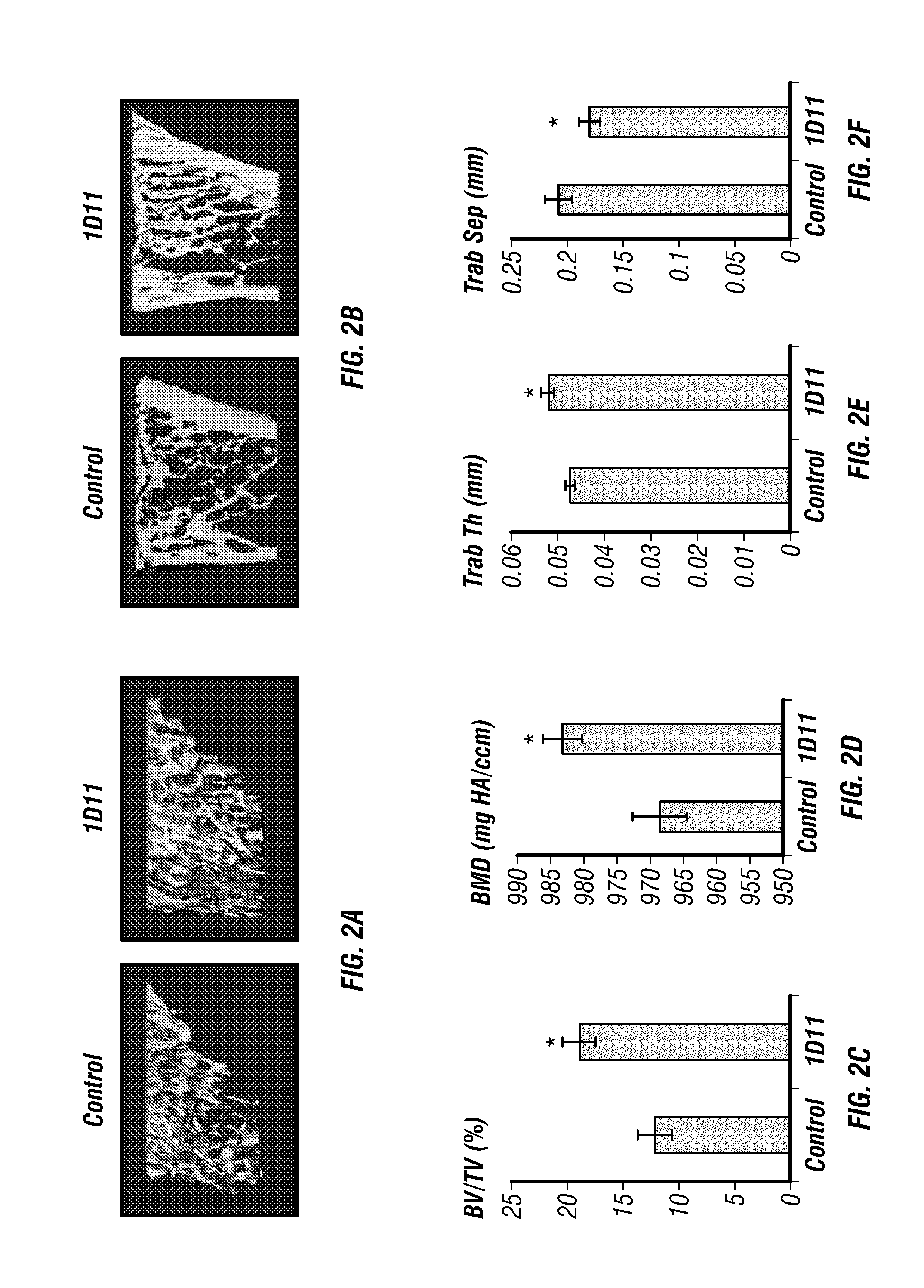 Anti-tgf-beta induction of bone cell function and bone growth