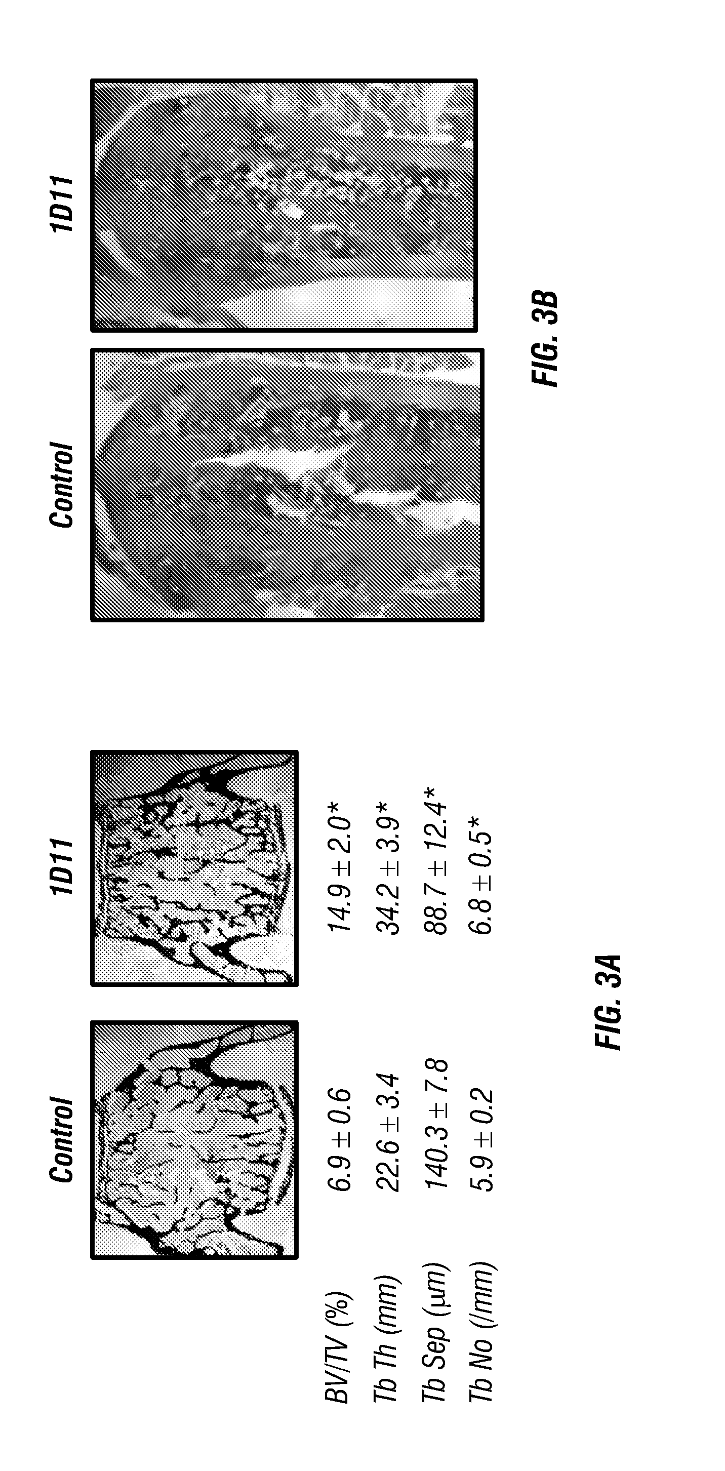 Anti-tgf-beta induction of bone cell function and bone growth