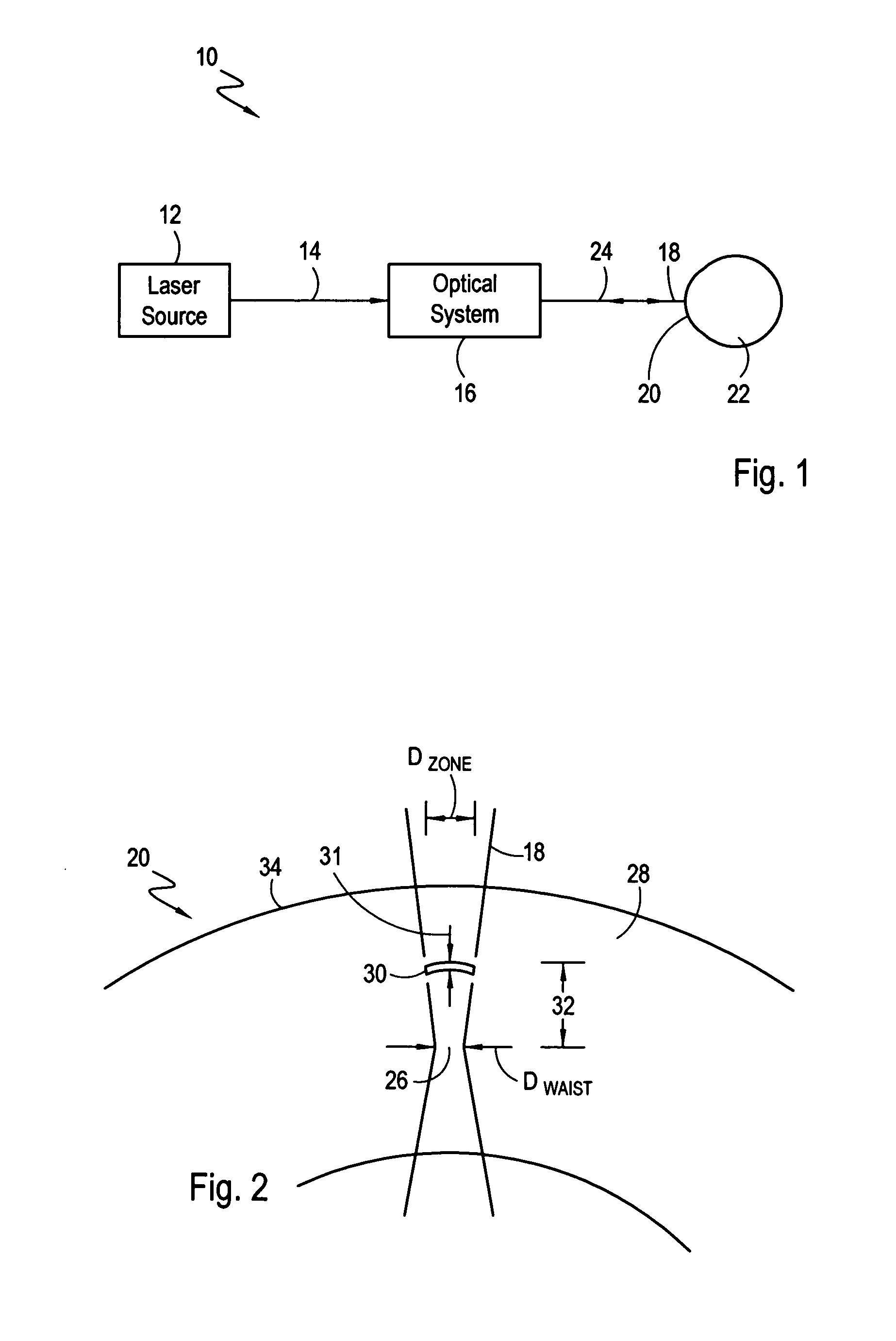 Method and apparatus for intrastromal refractive surgery
