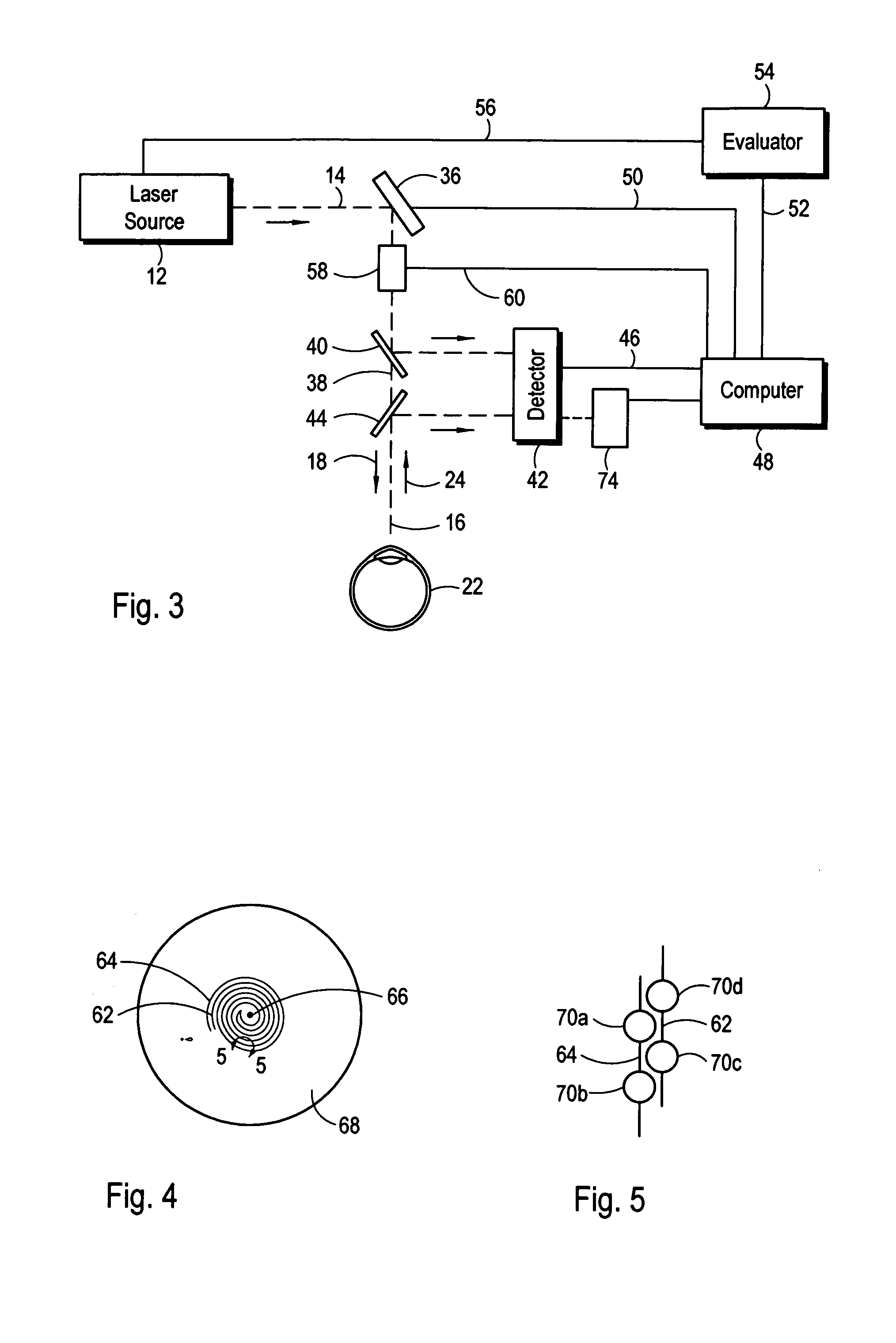 Method and apparatus for intrastromal refractive surgery