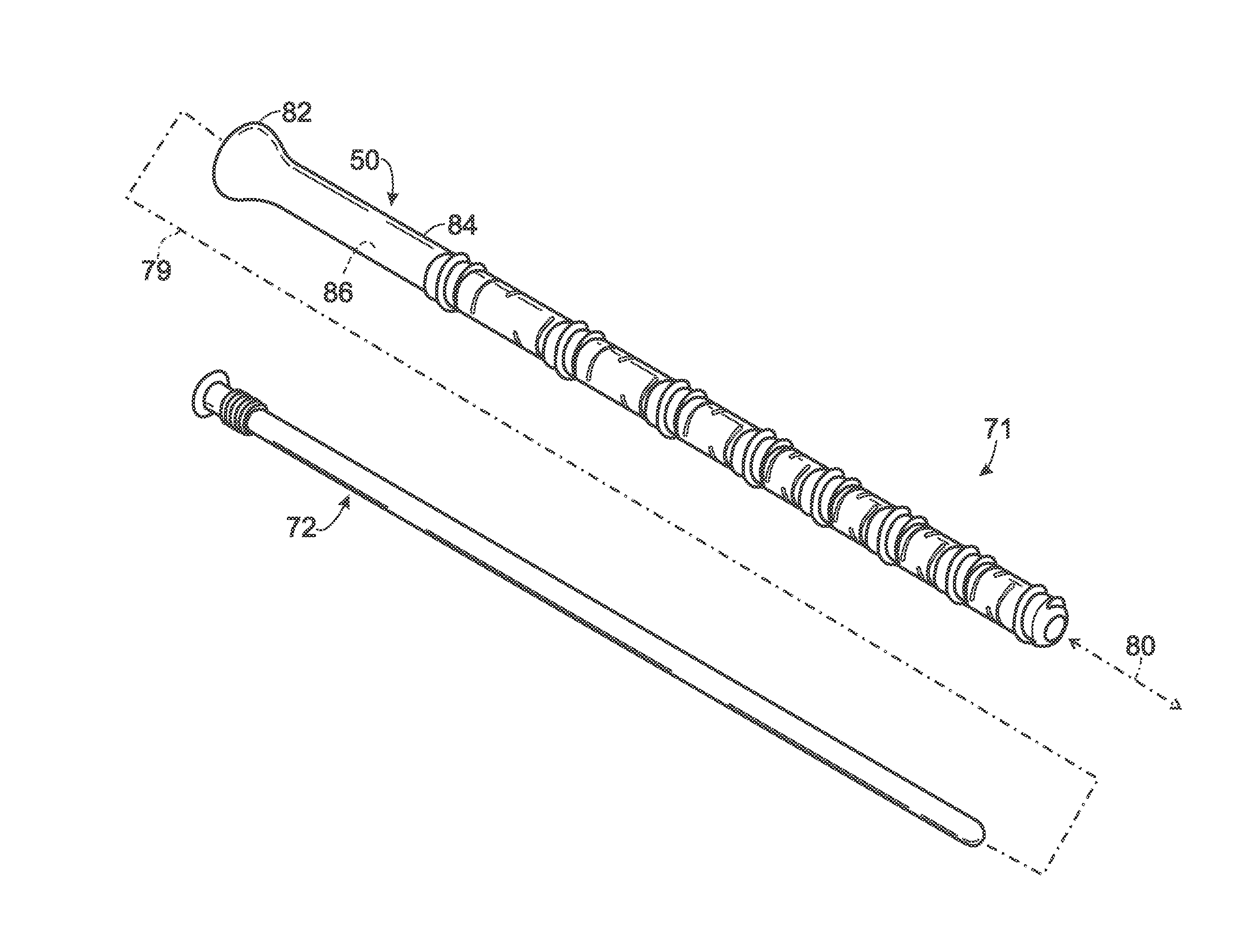 Steerable fastener for bone