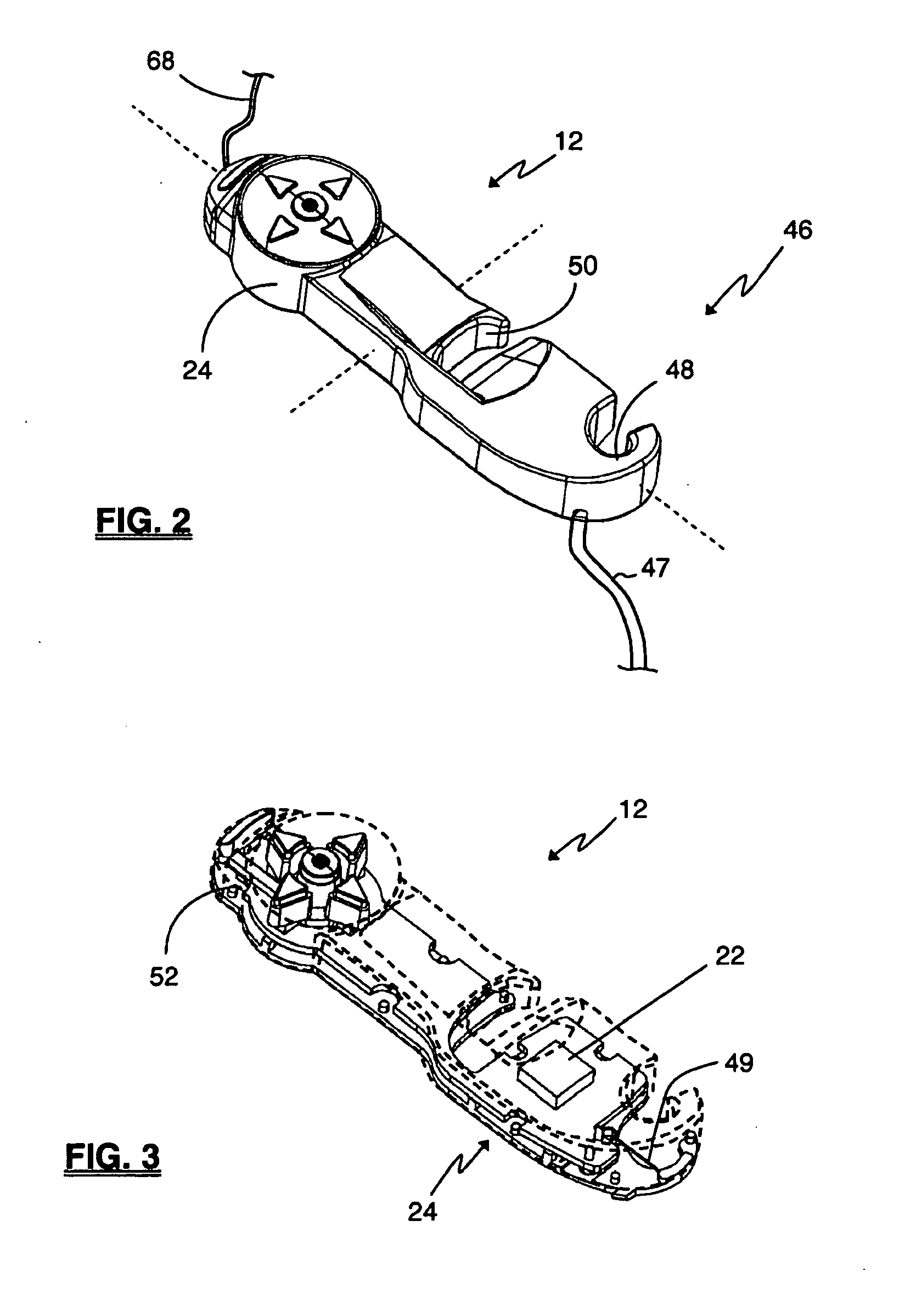 Surgical Trajectory Monitoring System and Related Methods