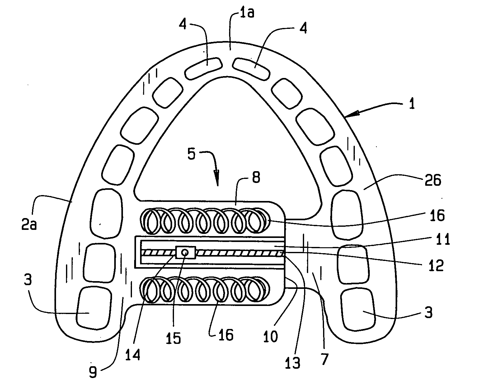 Maxillary arch expander unbanded to teeth