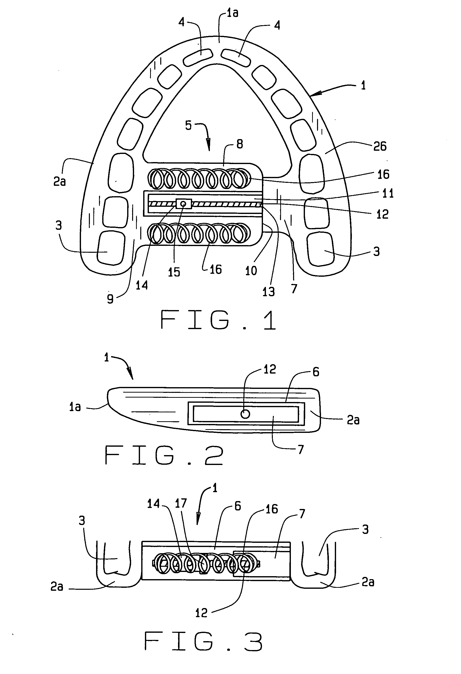 Maxillary arch expander unbanded to teeth