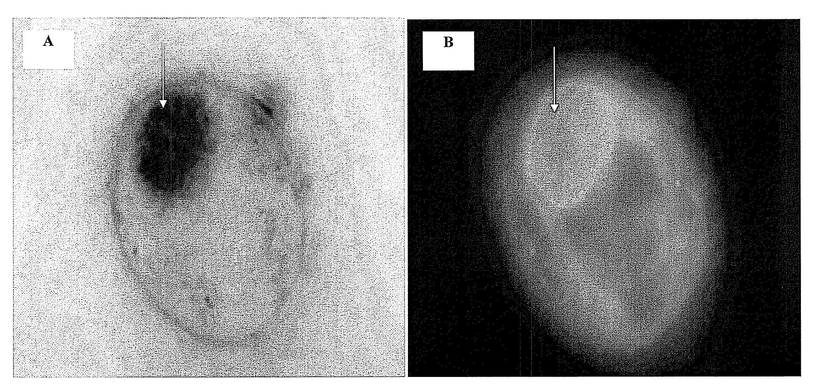 Nanoparticles for imaging and treating chlamydial infection