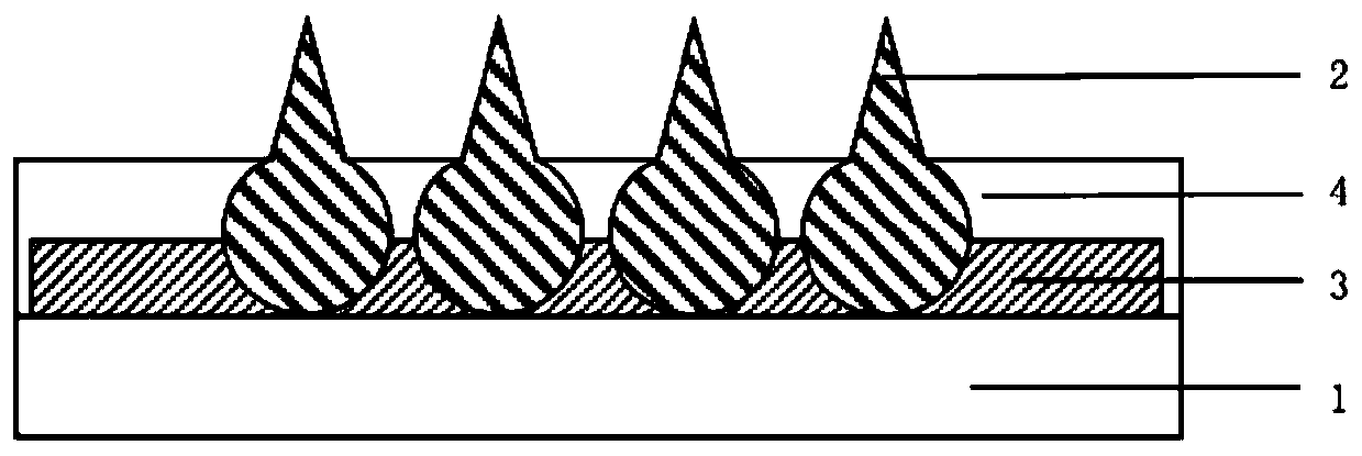 A kind of preparation method of microneedle system