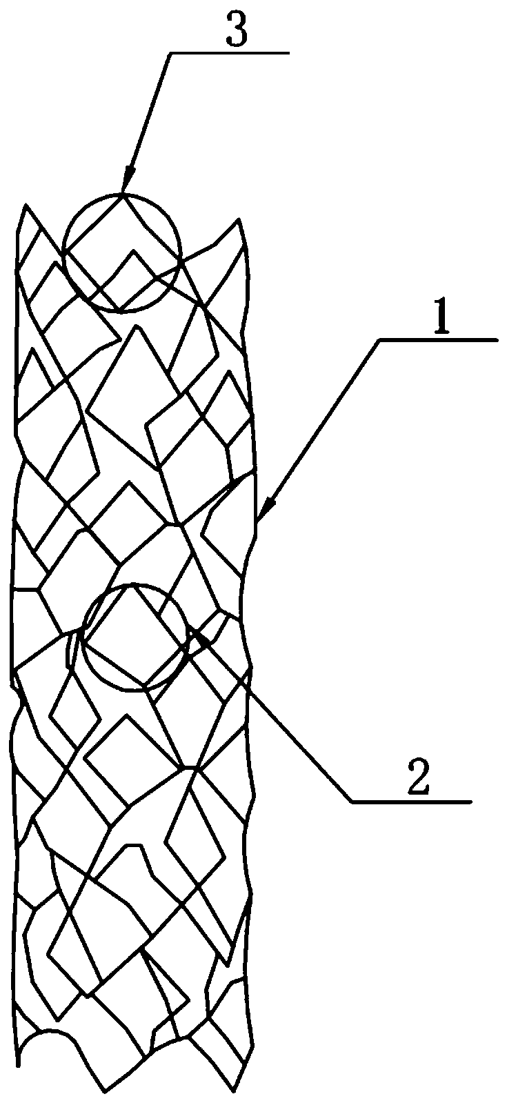 A vascular distraction device for lower extremity arteriosclerosis