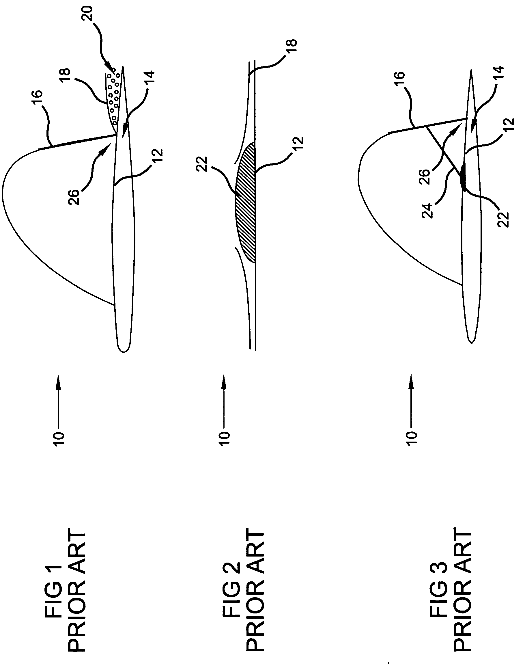 Dynamic bumps for drag reduction at transonic-supersonic speeds