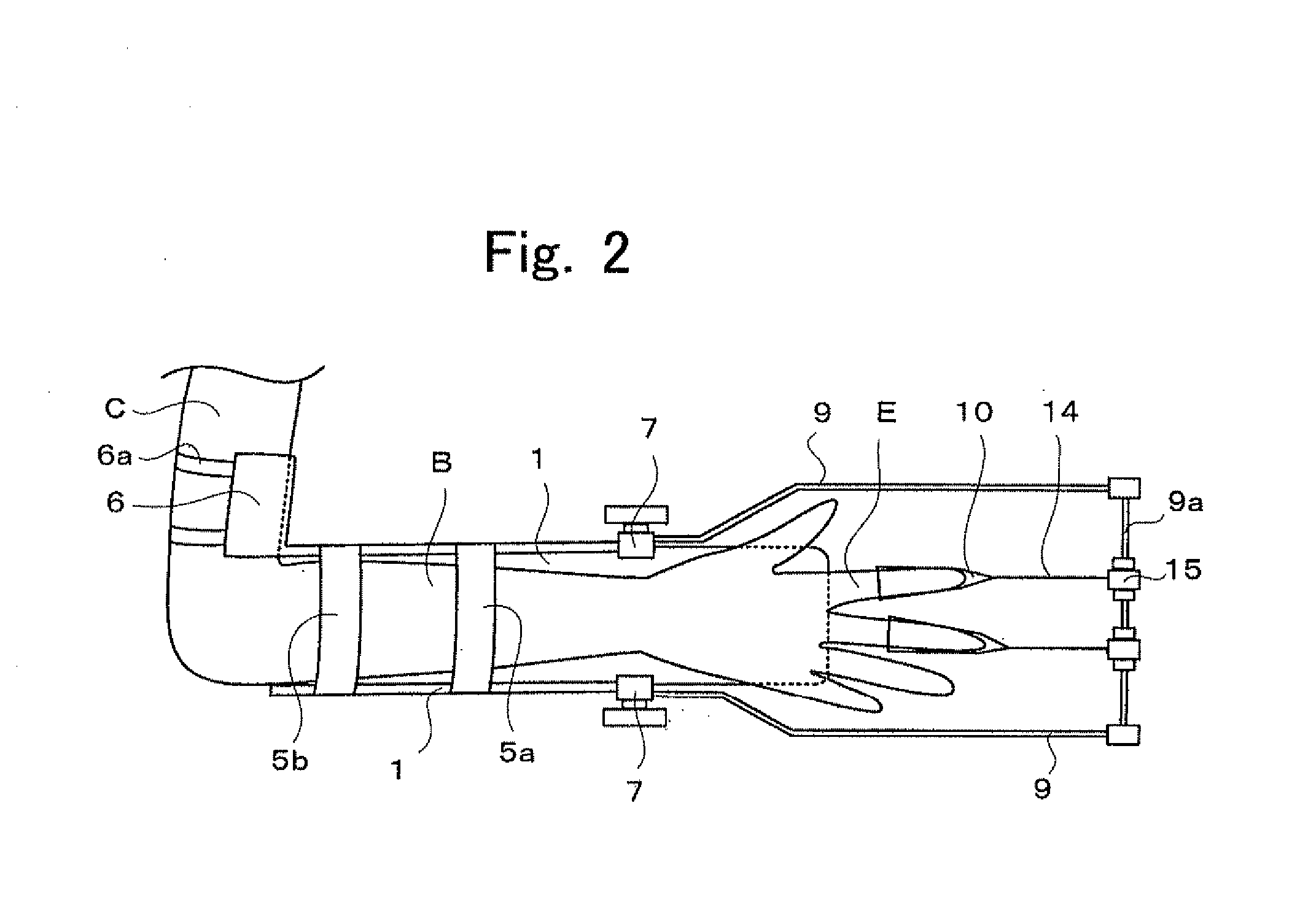 Portable or wearable fracture treatment device