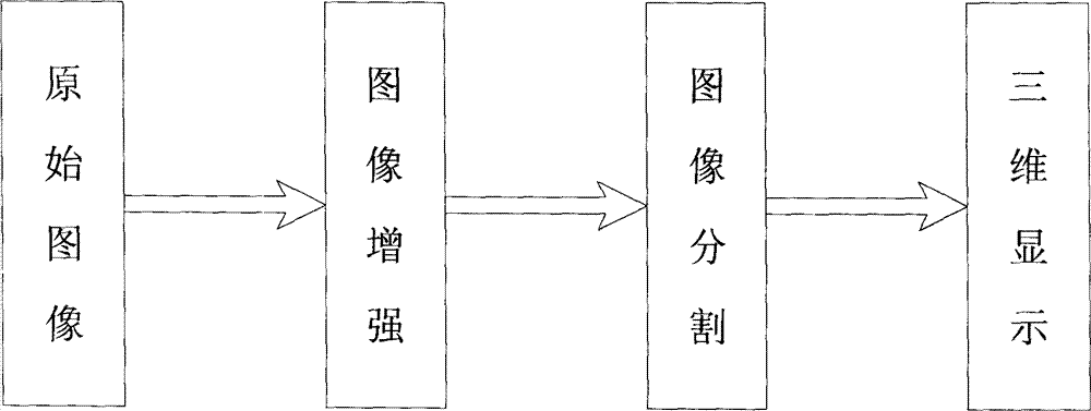 Underwater sub-wavelength resolution ratio three-dimensional imaging method