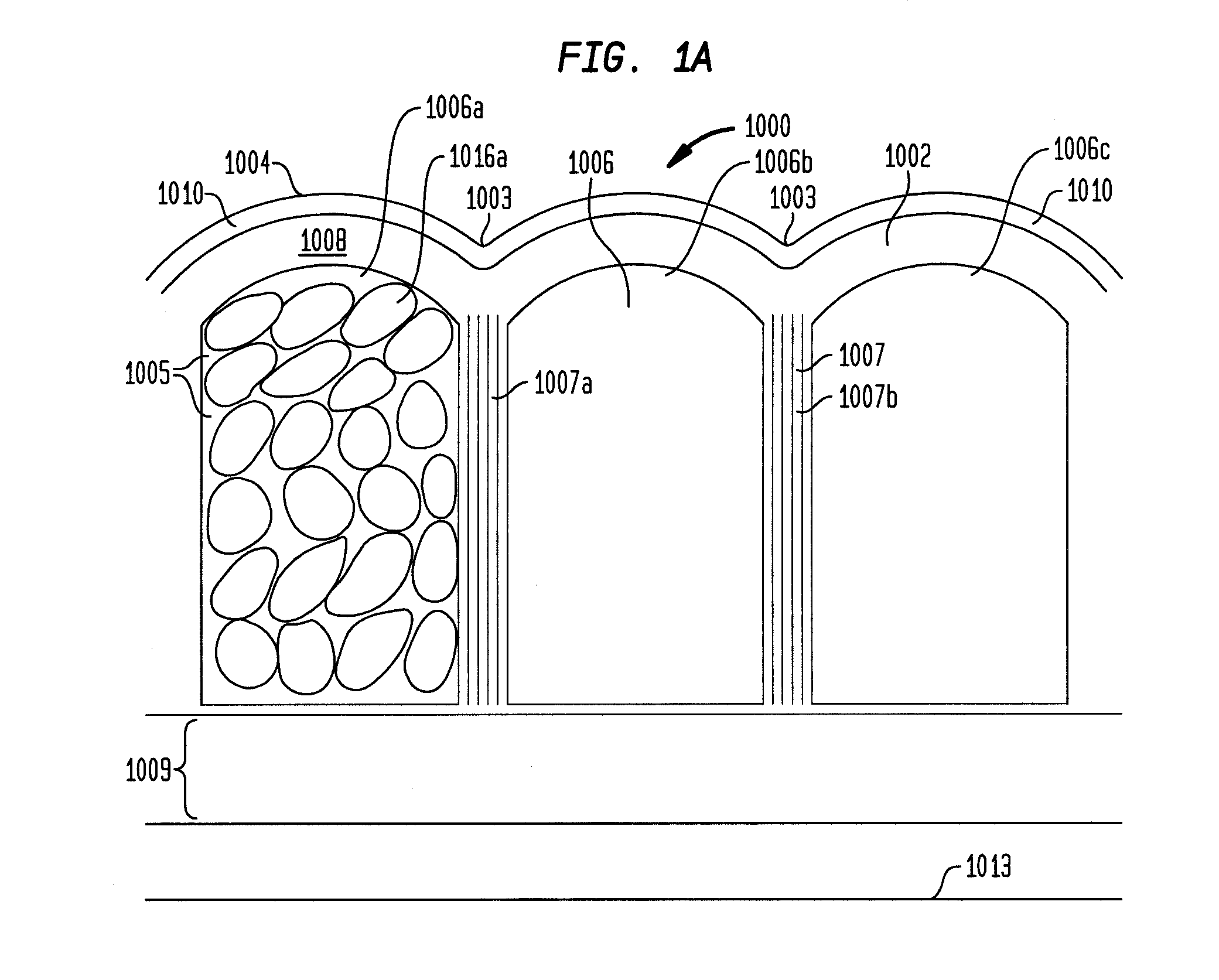 Method for improvement of cellulite appearance