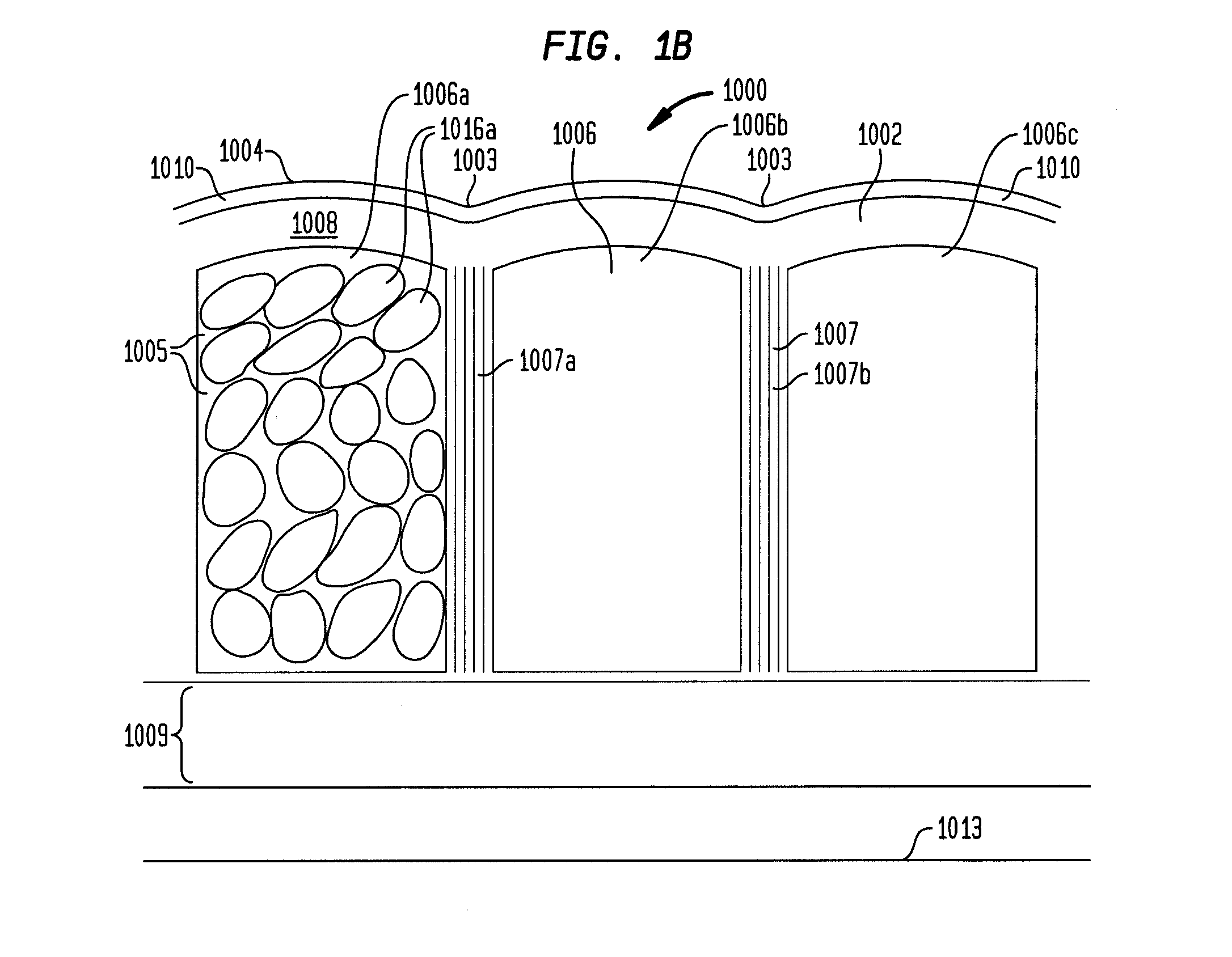 Method for improvement of cellulite appearance