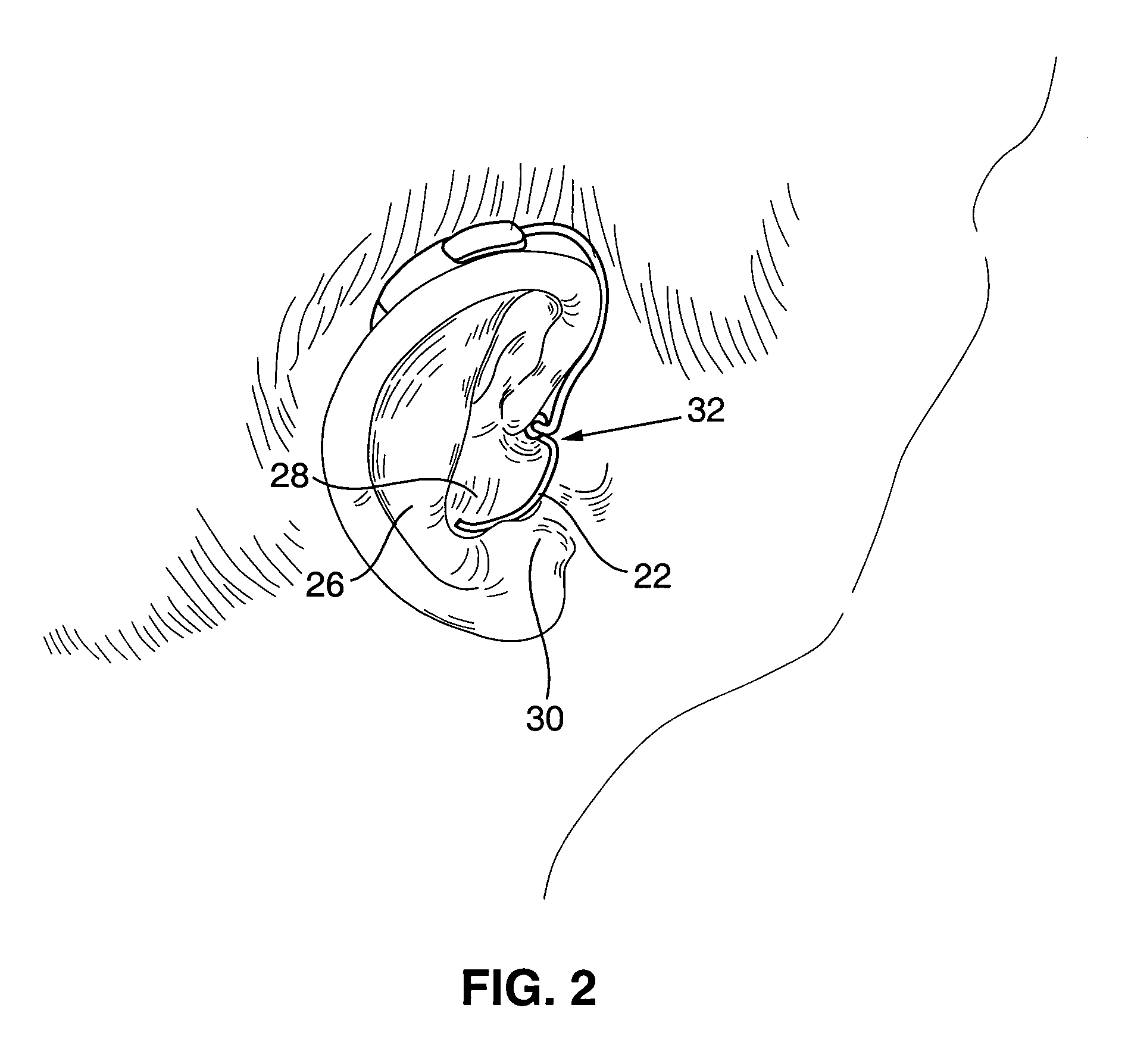 Retaining member for an earpiece