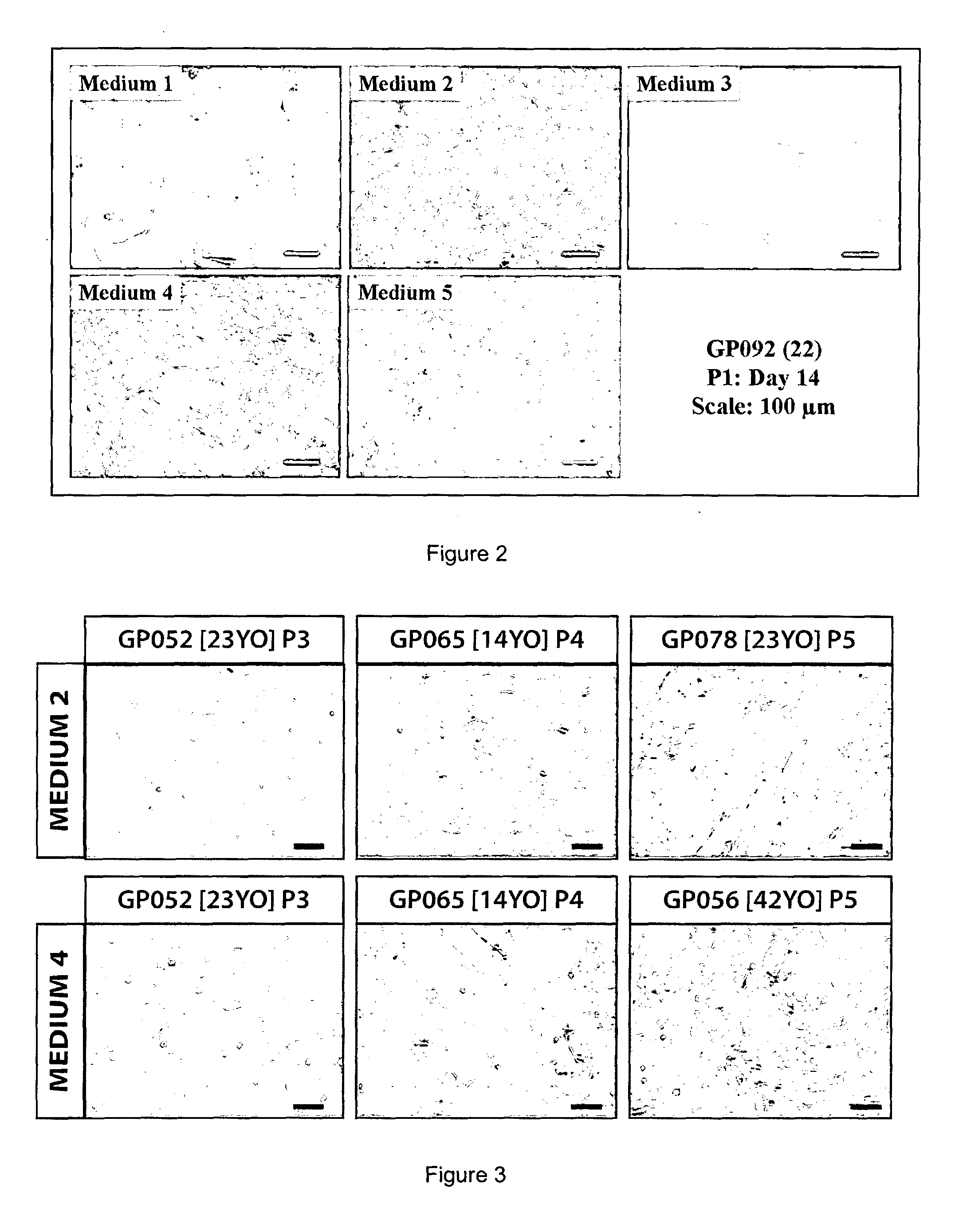 Cell culture of corneal endothelial cells